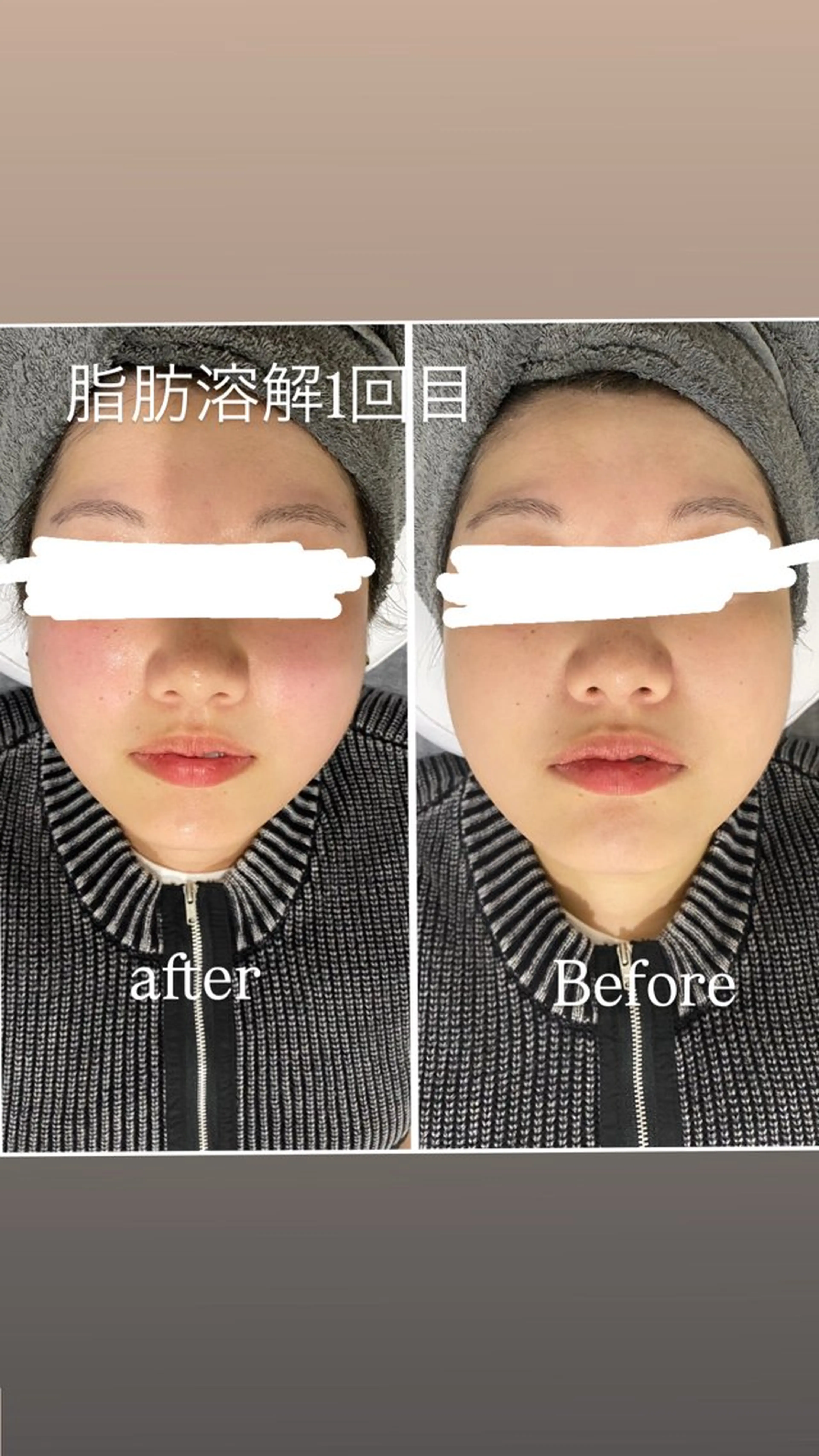 エステ 毛穴洗浄・痩身・脱毛 /アルカンジュのエステ・リラクイメージ