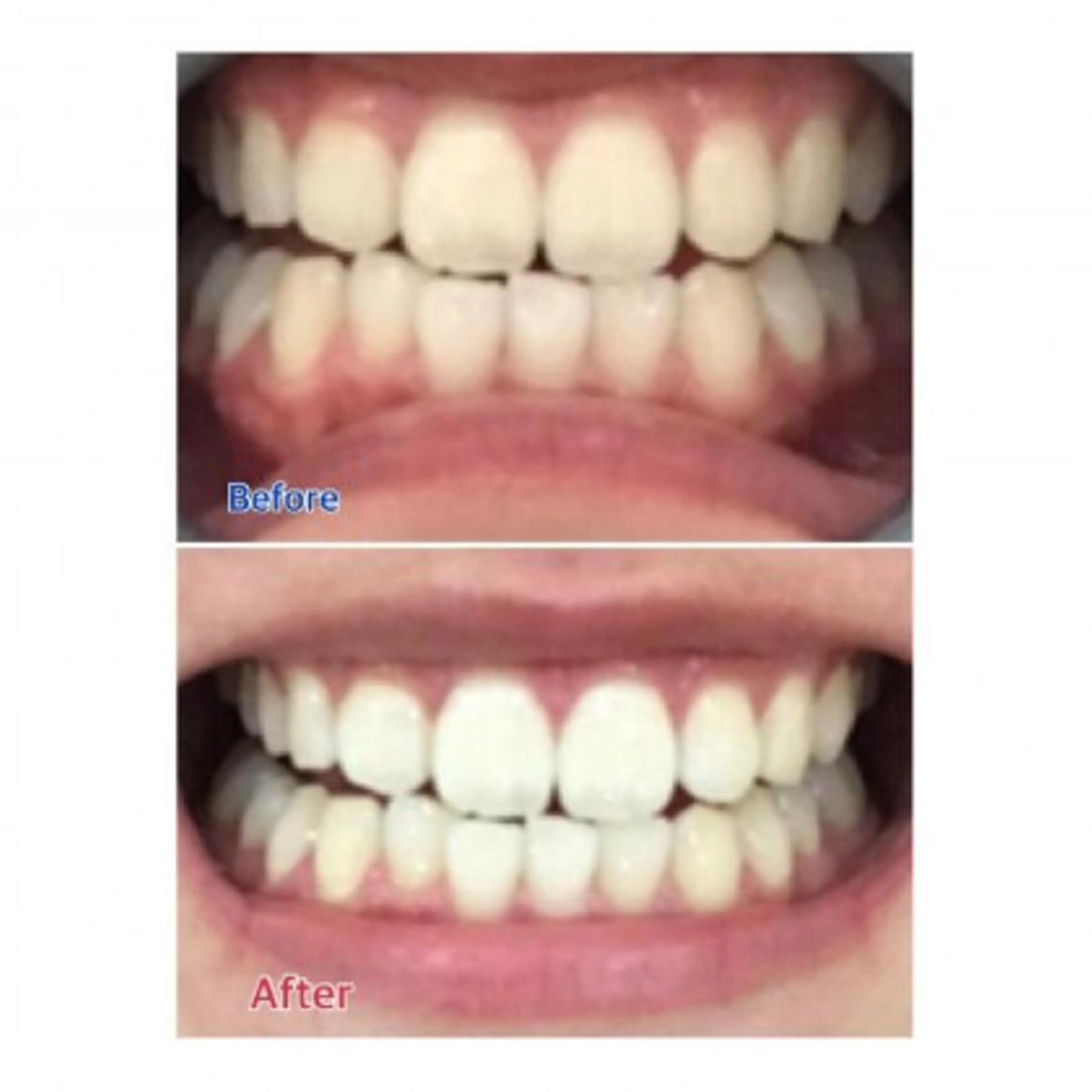 M渋谷店所属・Ｍ渋谷 ホワイトニングのエステ・リラクイメージ