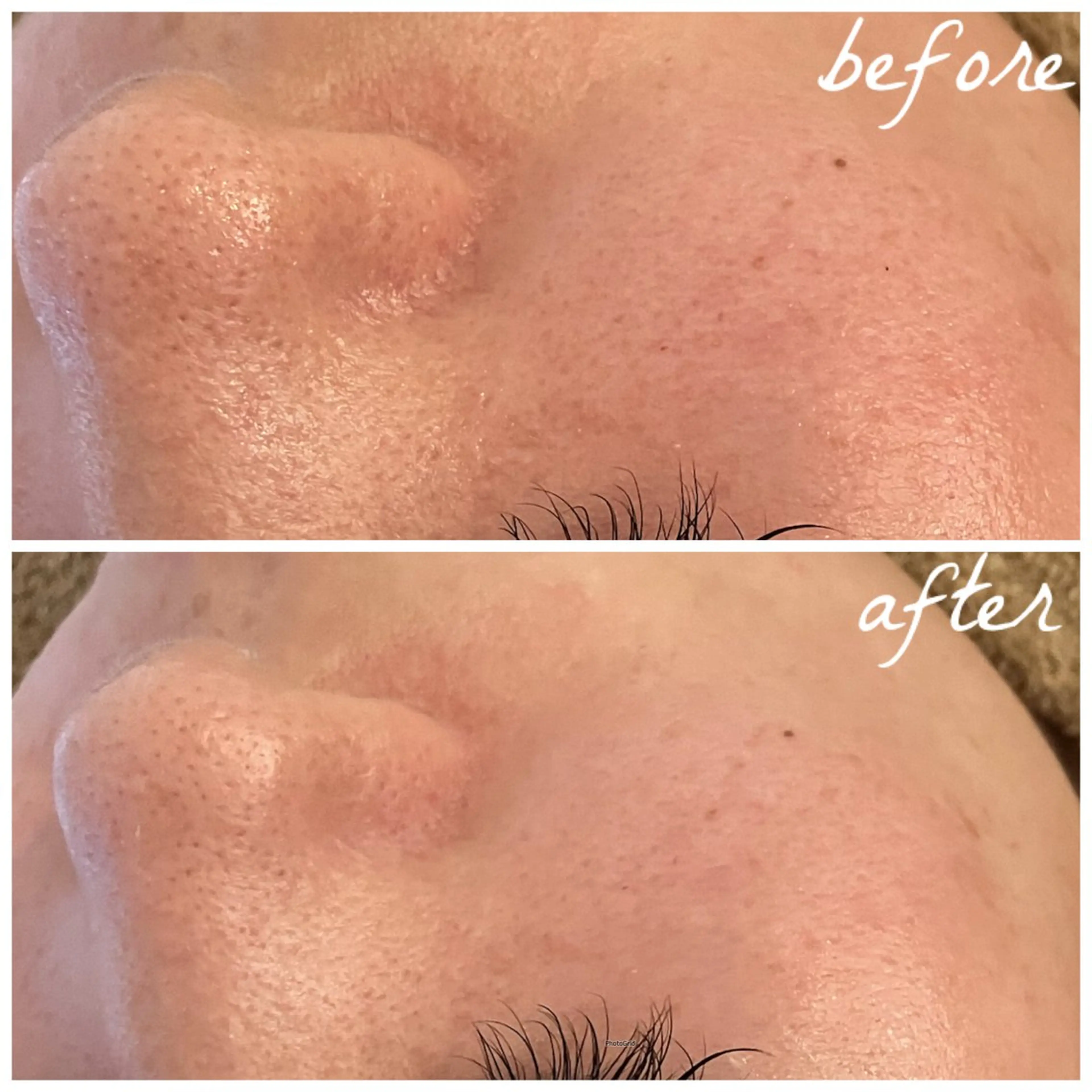 メンズ エステ メナード岐阜茜部 杉浦のエステ・リラクイメージ