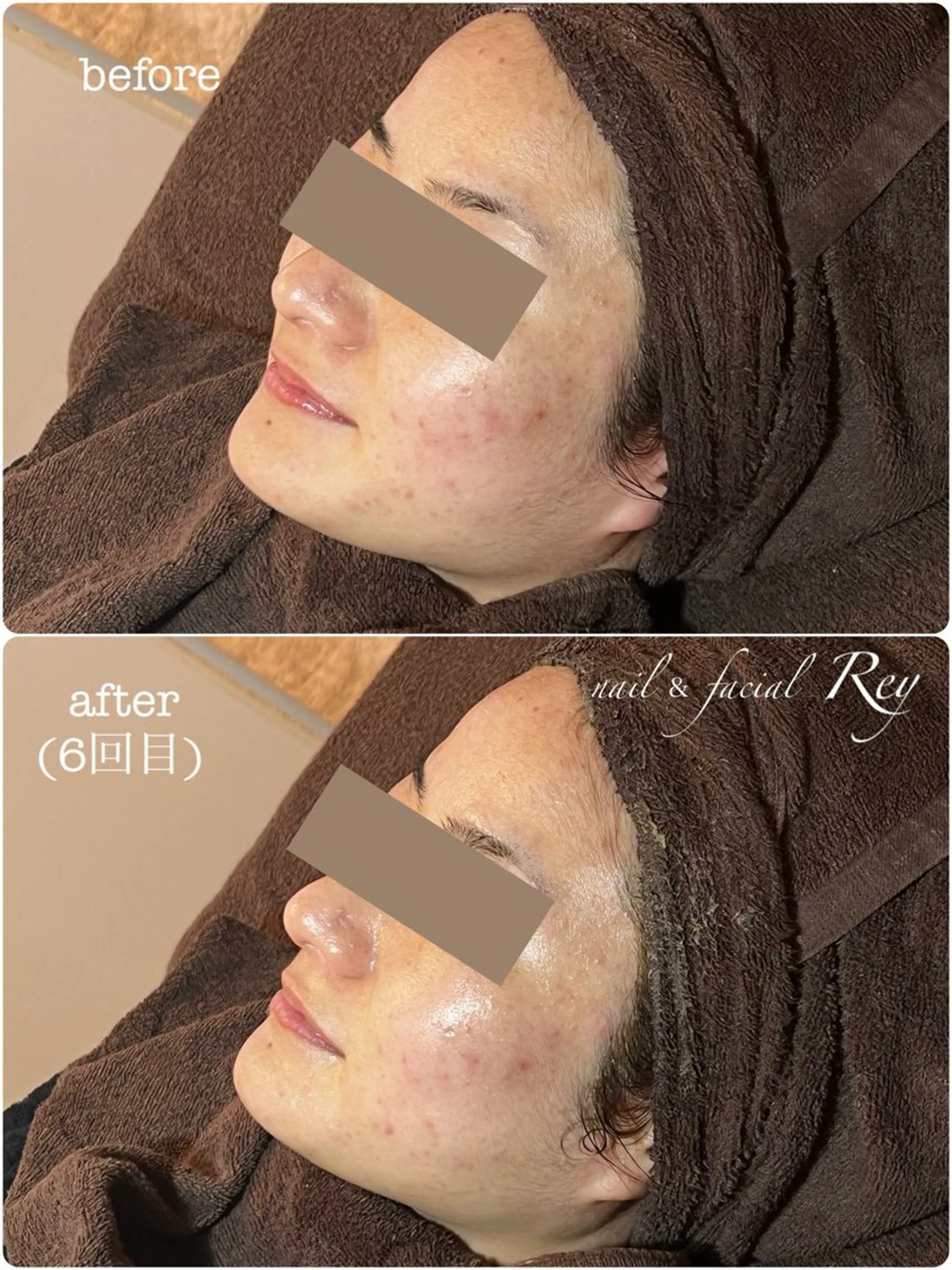 エステ R eyのネイルデザイン