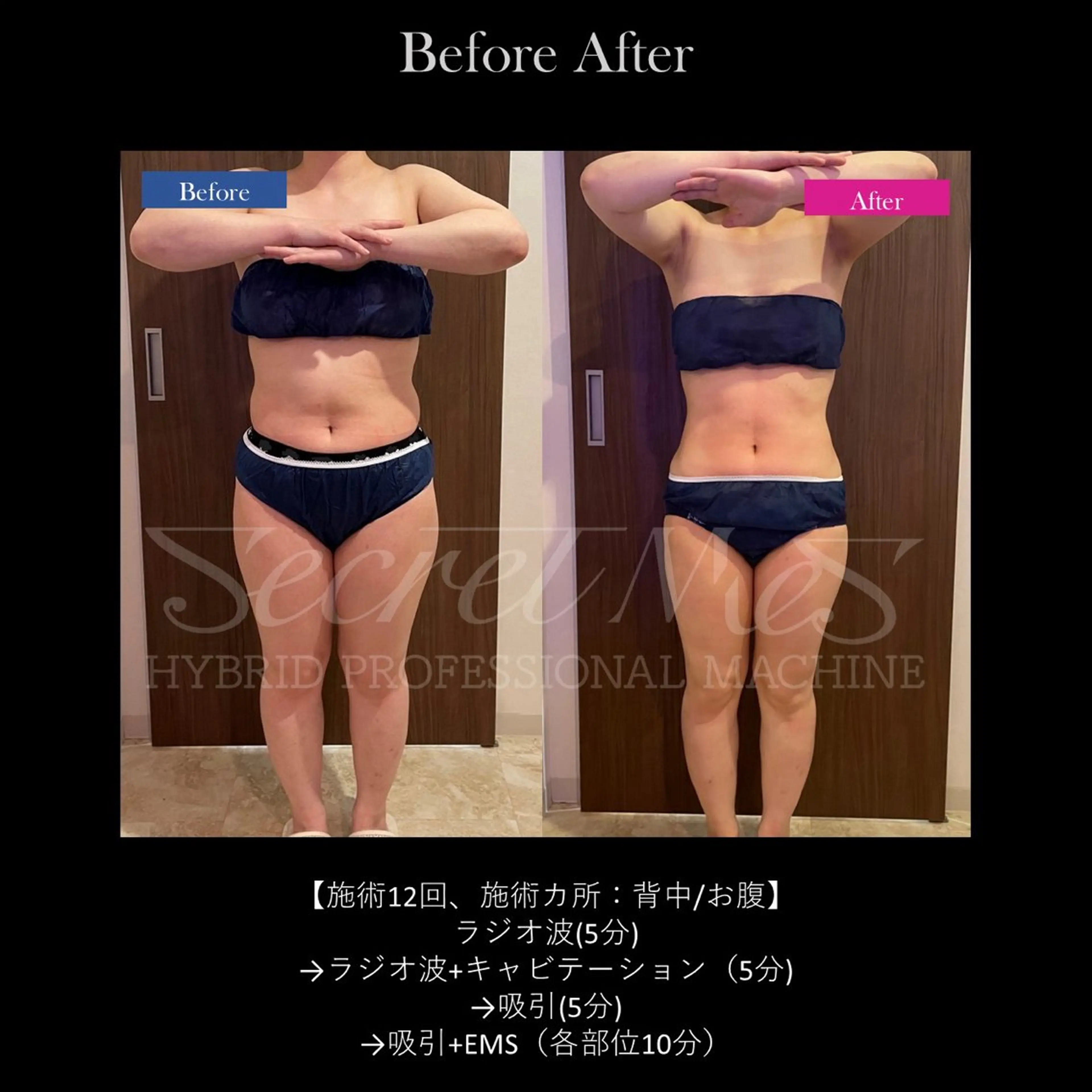 Bellvie beauty salon所属・Bellvie かすみのエステ・リラクイメージ