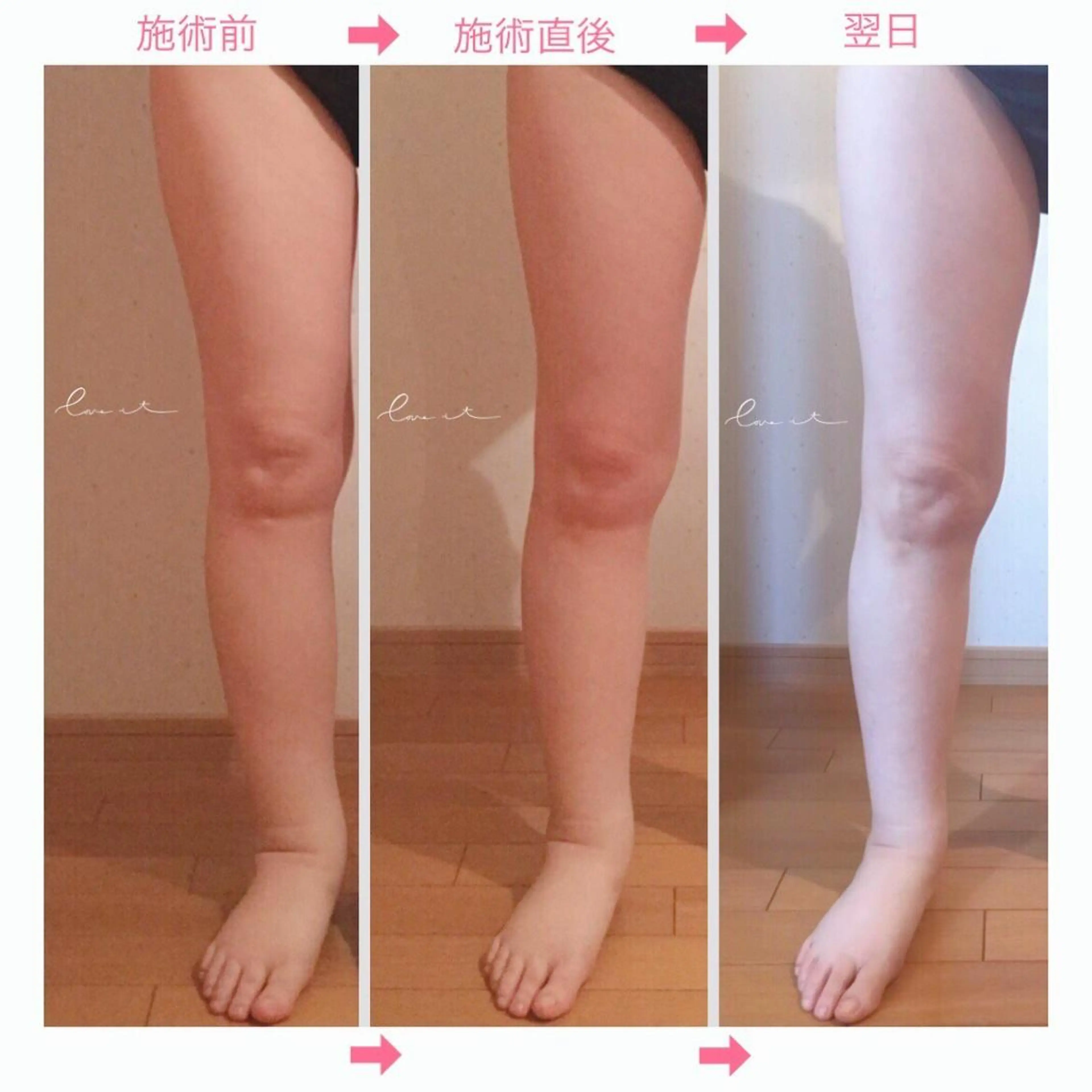 Lov. it ﾗｳﾞｨｯﾄのエステ・リラクイメージ