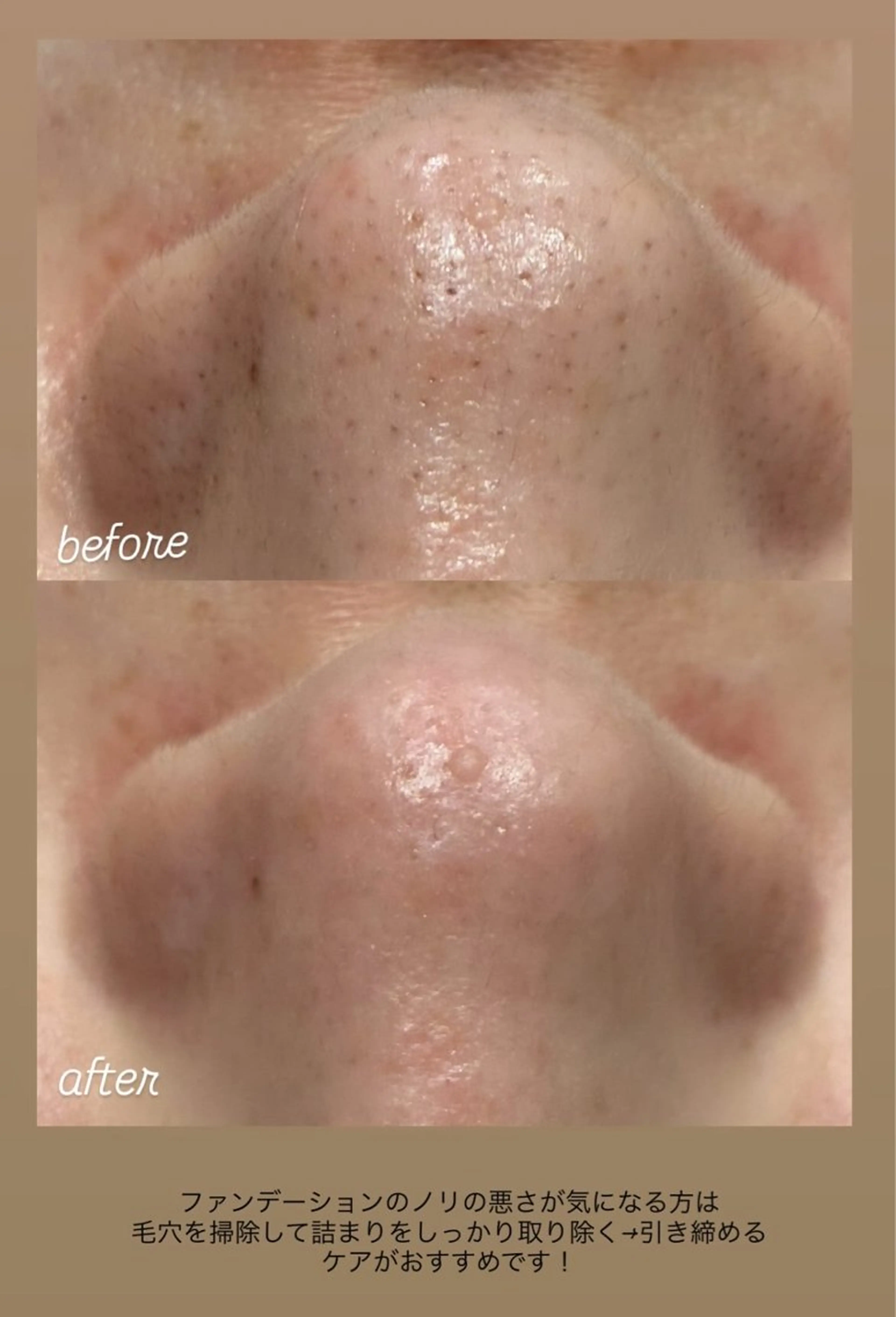 エステ DahliaBeauty ダリアビューティー所属・DahliaBeau tyフェイシャル中村のエステ・リラクイメージ