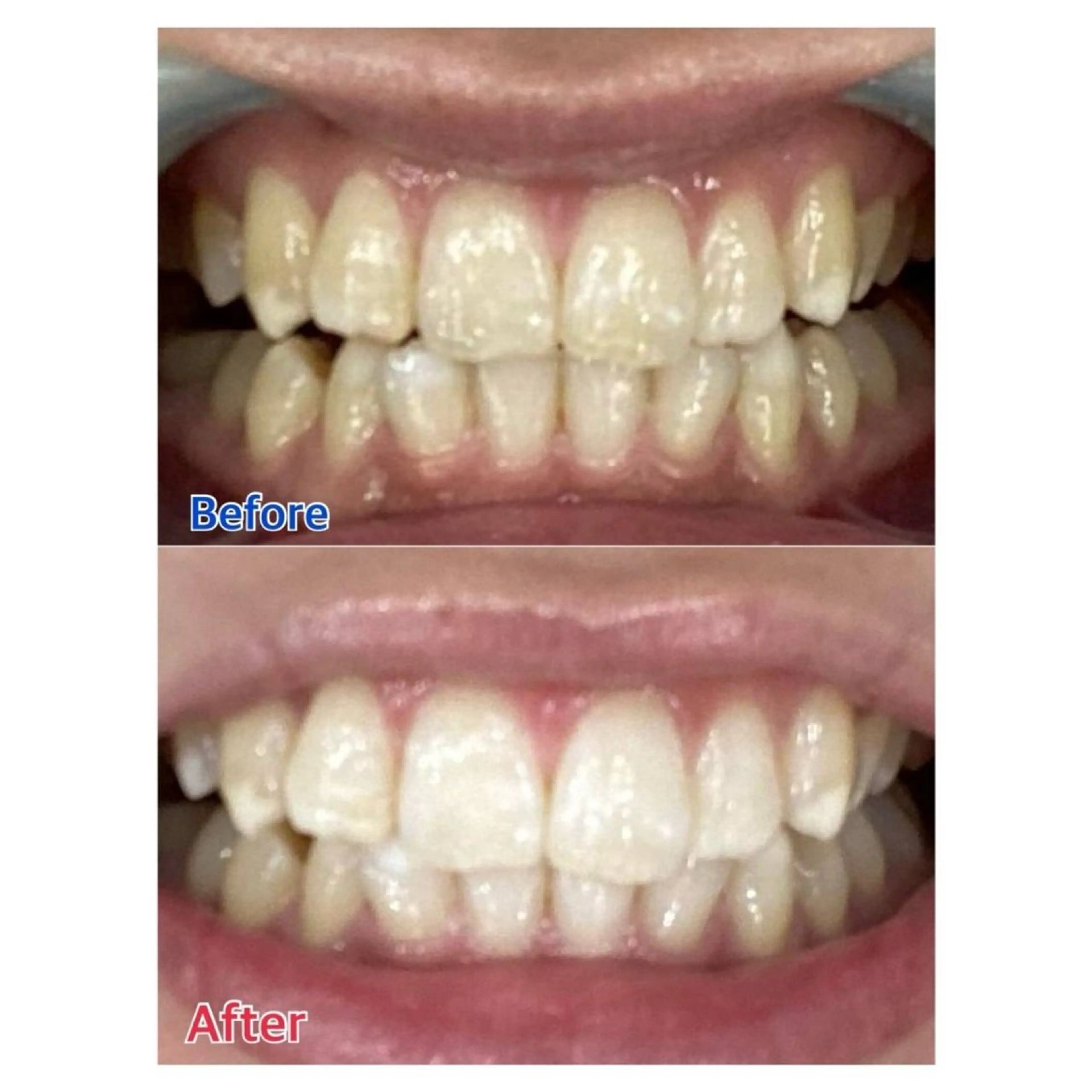 MBEAUTYSALON 千葉店・京成大久保所属・Melty 輝のその他イメージ