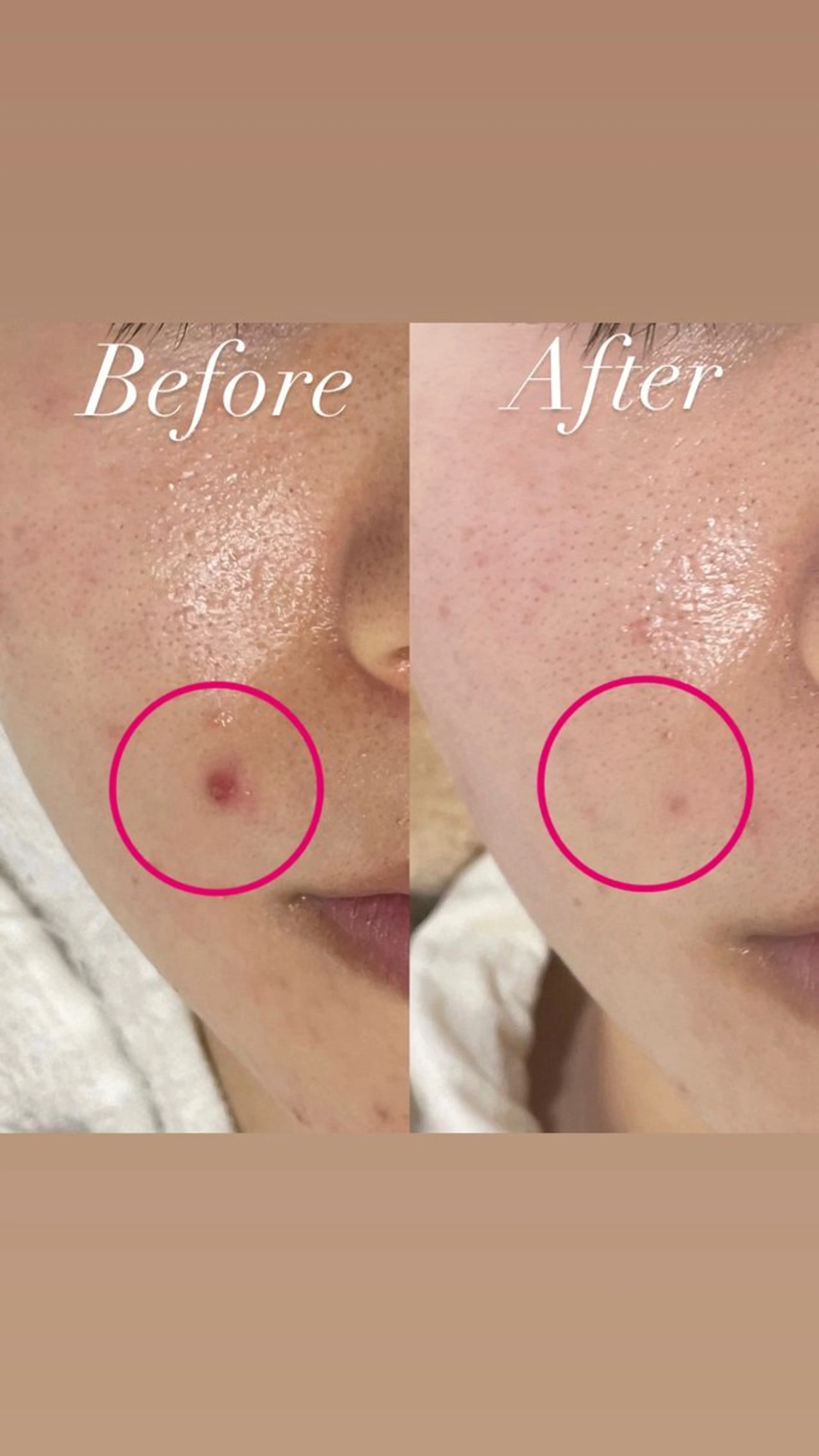 エステ プライベートサロン Belle（ベル）のエステ・リラクイメージ