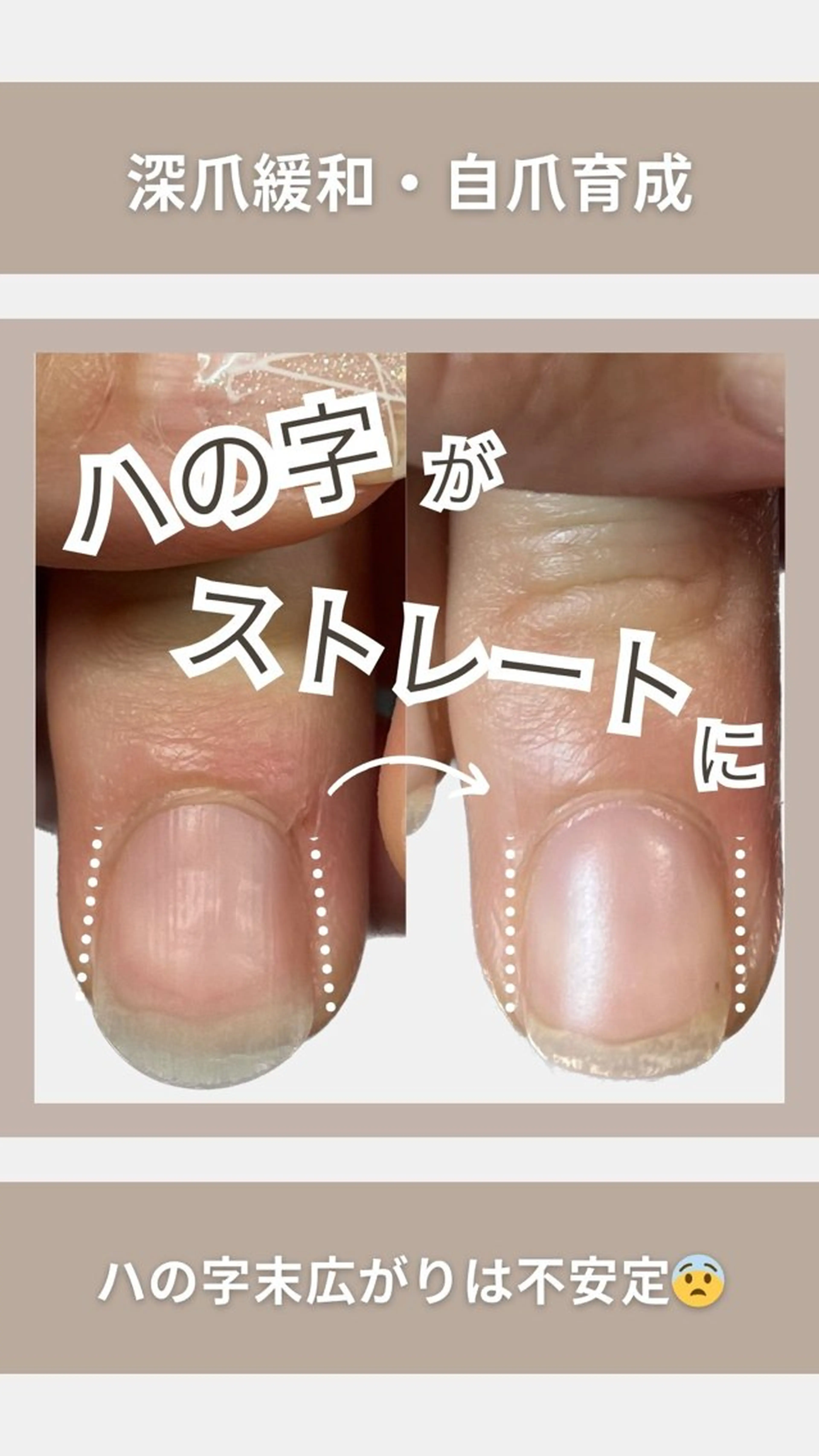ネイル KIKOA NAIL キコアネイルのネイルデザイン