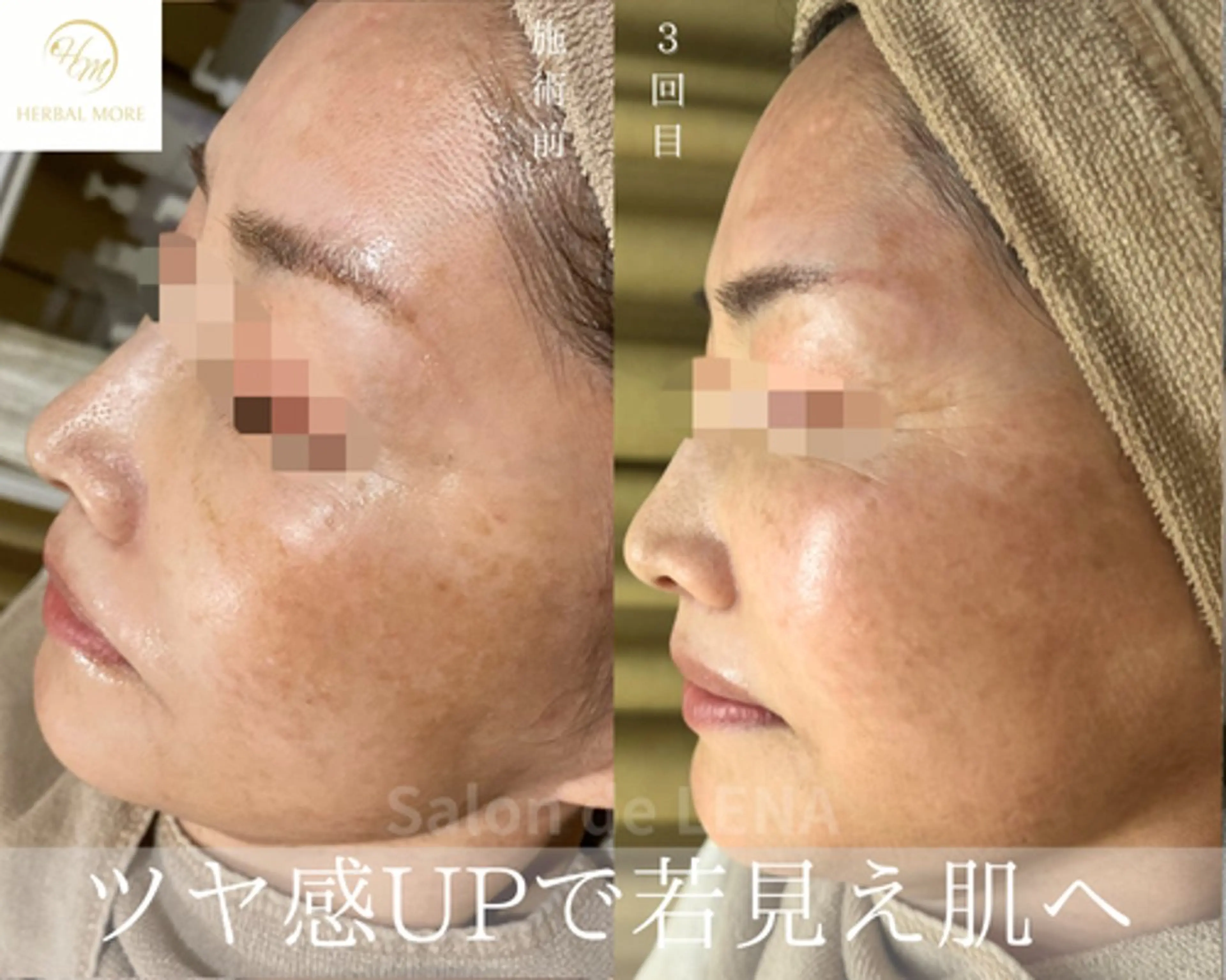 エステ サロンドレナ名駅店所属・ハーブピーリング専門 サロンドレナ平岡のエステ・リラクイメージ