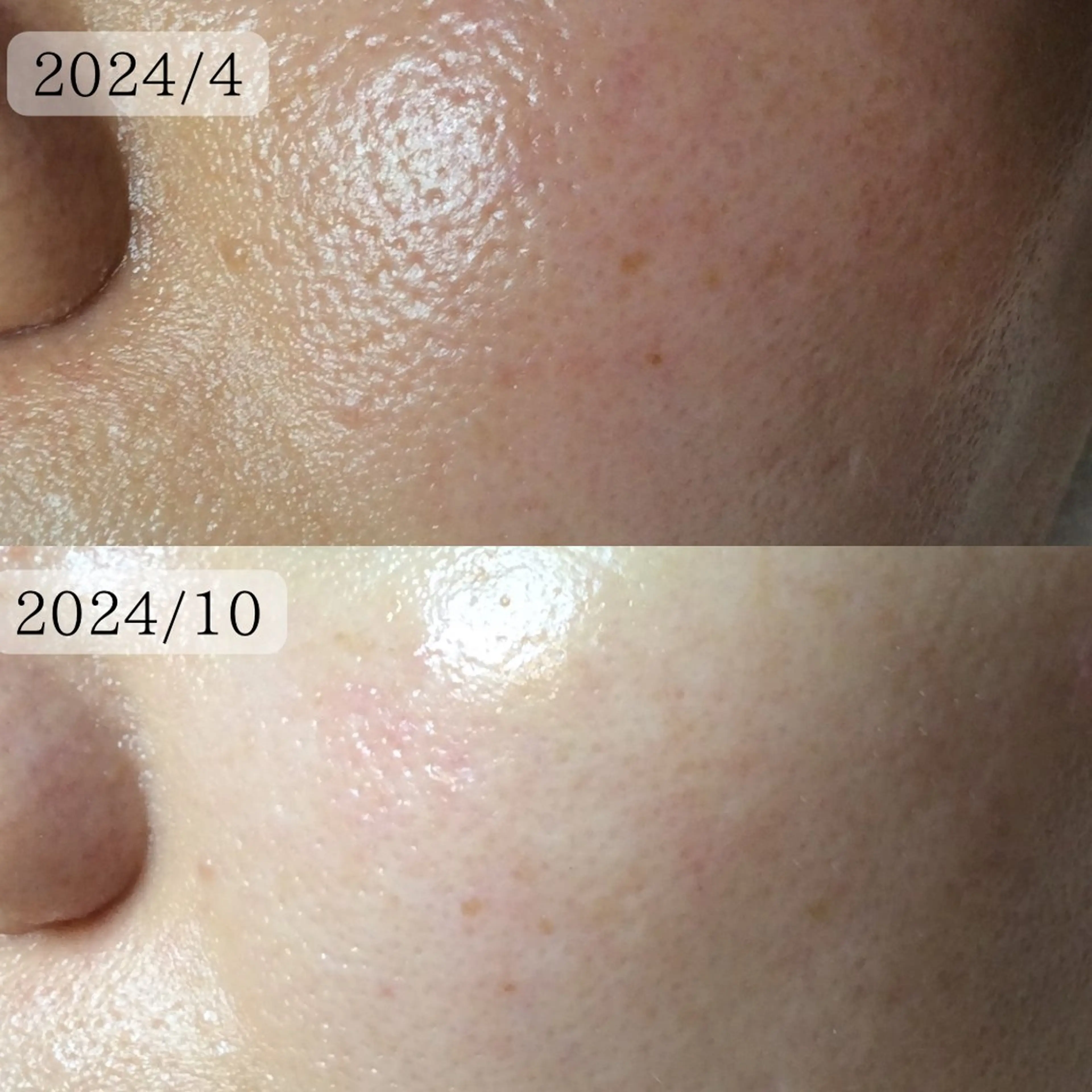 エステサロン　Lazulisea所属・川口 春奈のエステ・リラクイメージ