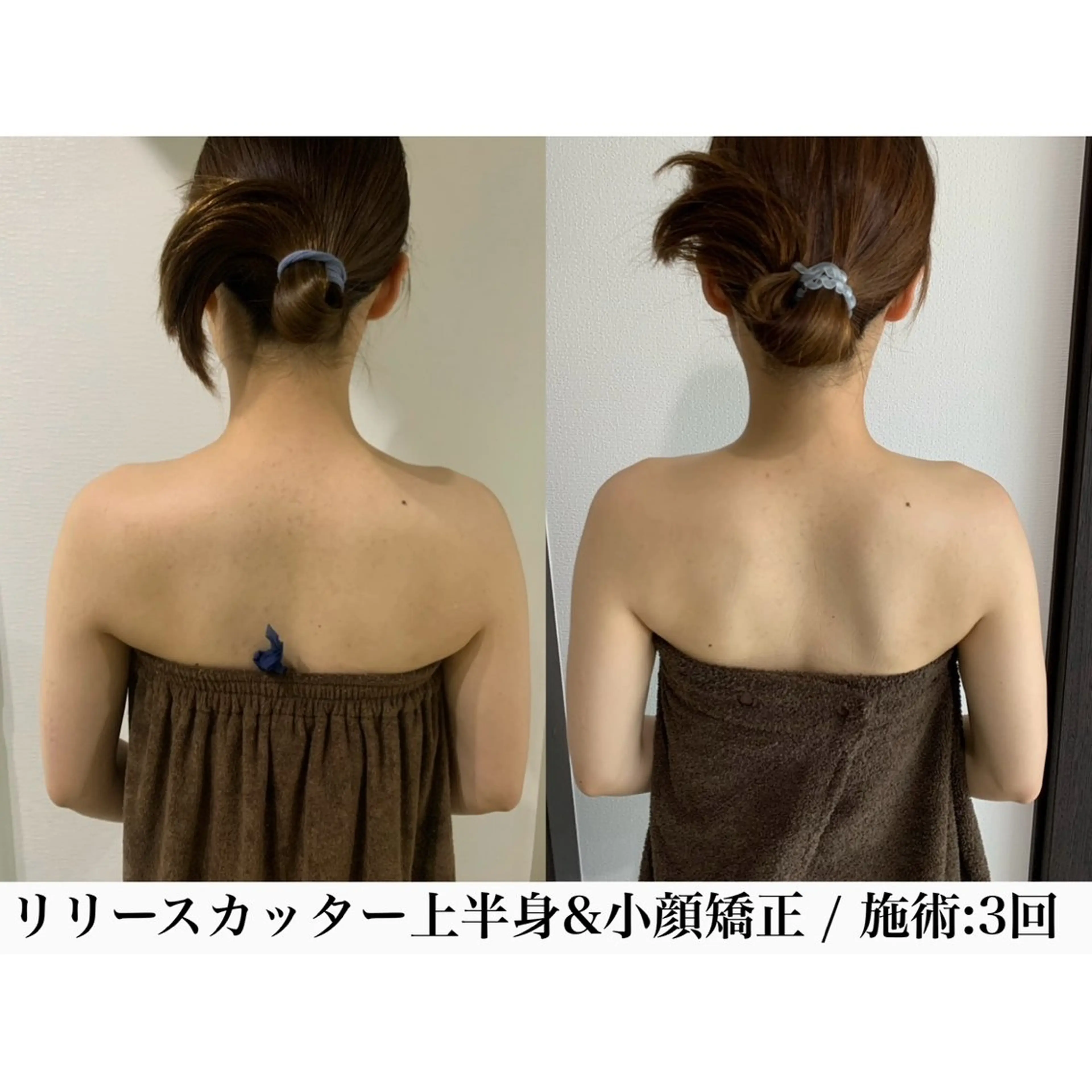 堀之内宏次 ［美容鍼灸師］のエステ・リラクイメージ