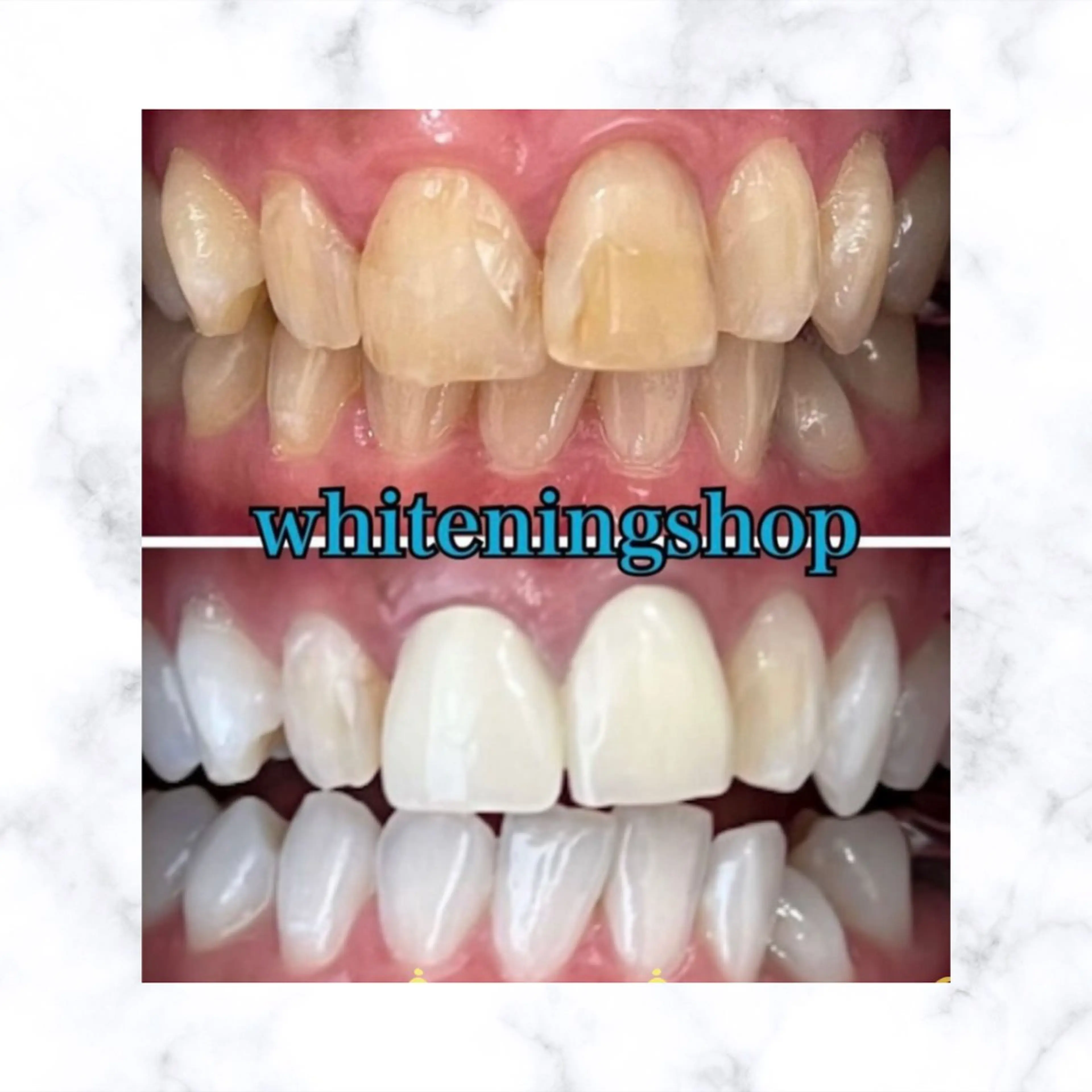 ホワイトニングショップ時津店所属・ホワイトニング ショップ長崎時津店のその他イメージ