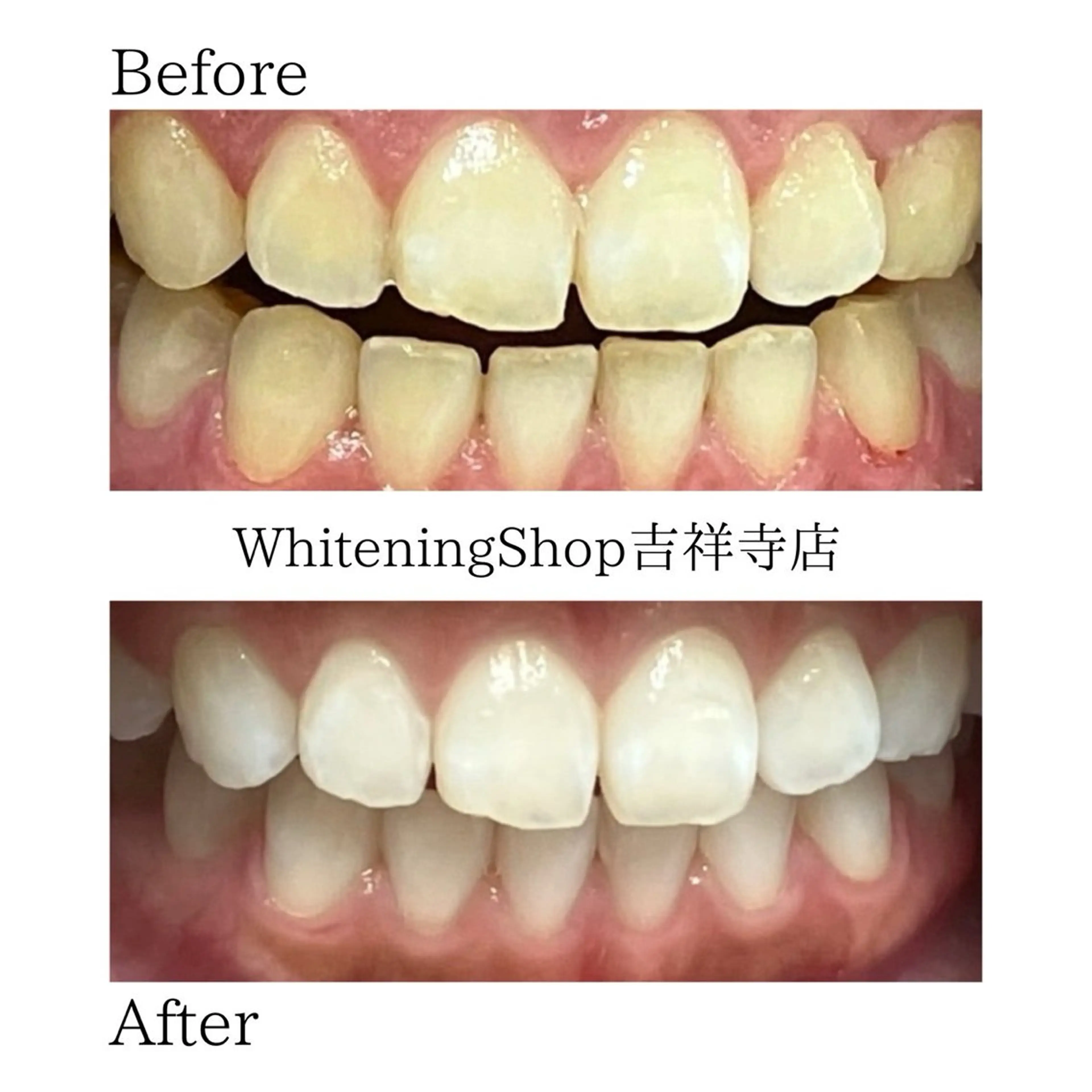 エステ リラク ホワイトニング ショップ吉祥寺店のエステ・リラクイメージ