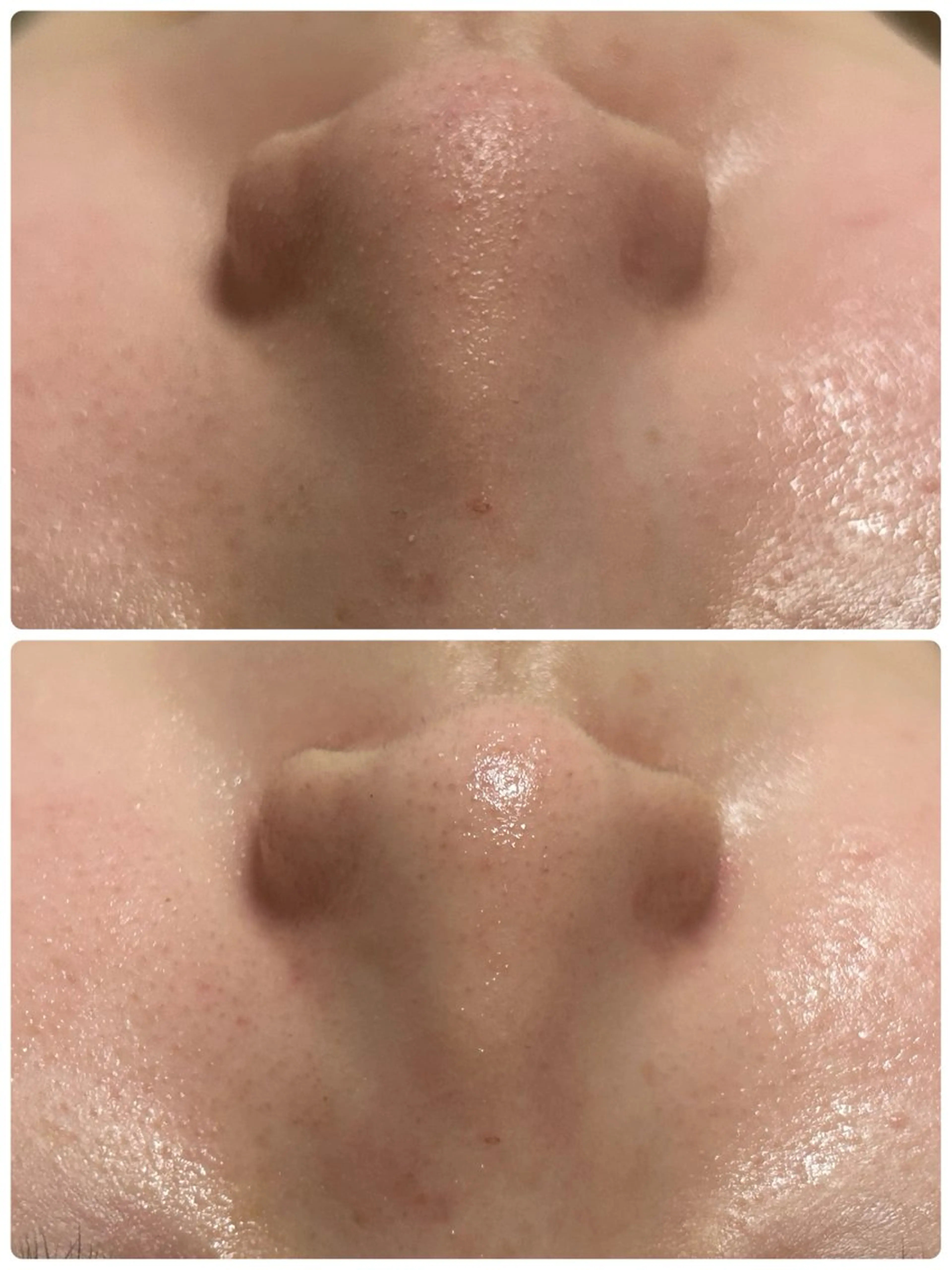 エステ フェイシャルサロン CHIARA 荒田のエステ・リラクイメージ