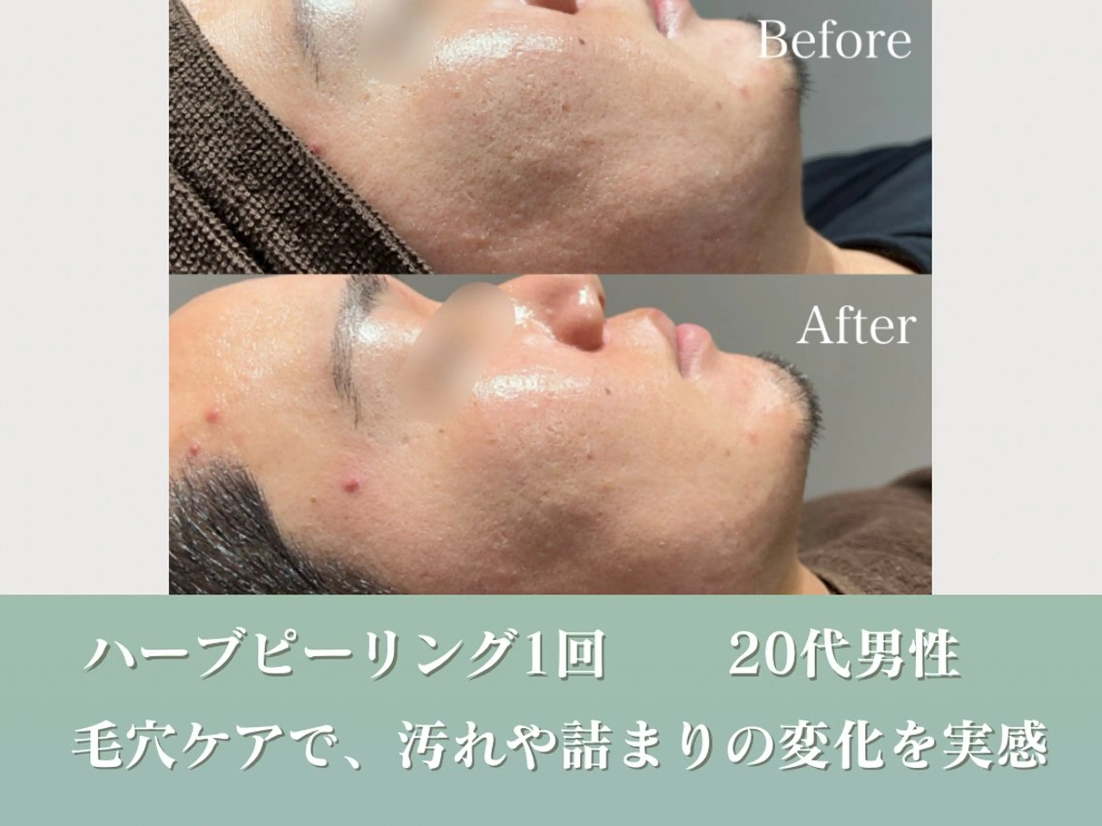 潤い艶肌／肌質改善 YUKAのエステ・リラクイメージ