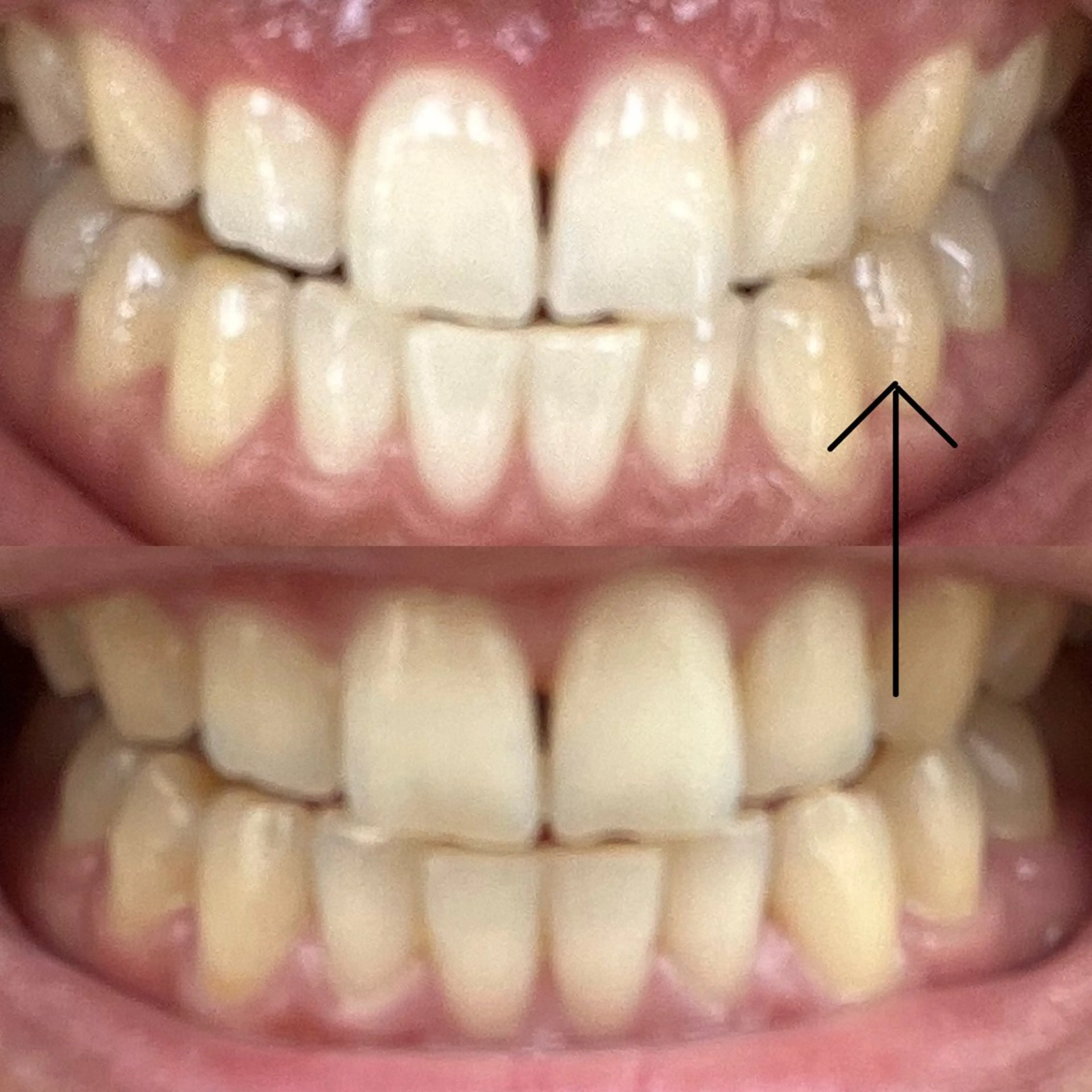 その他 エクシアホワイトニング草津店所属・nanami -ホワイトニングのその他イメージ