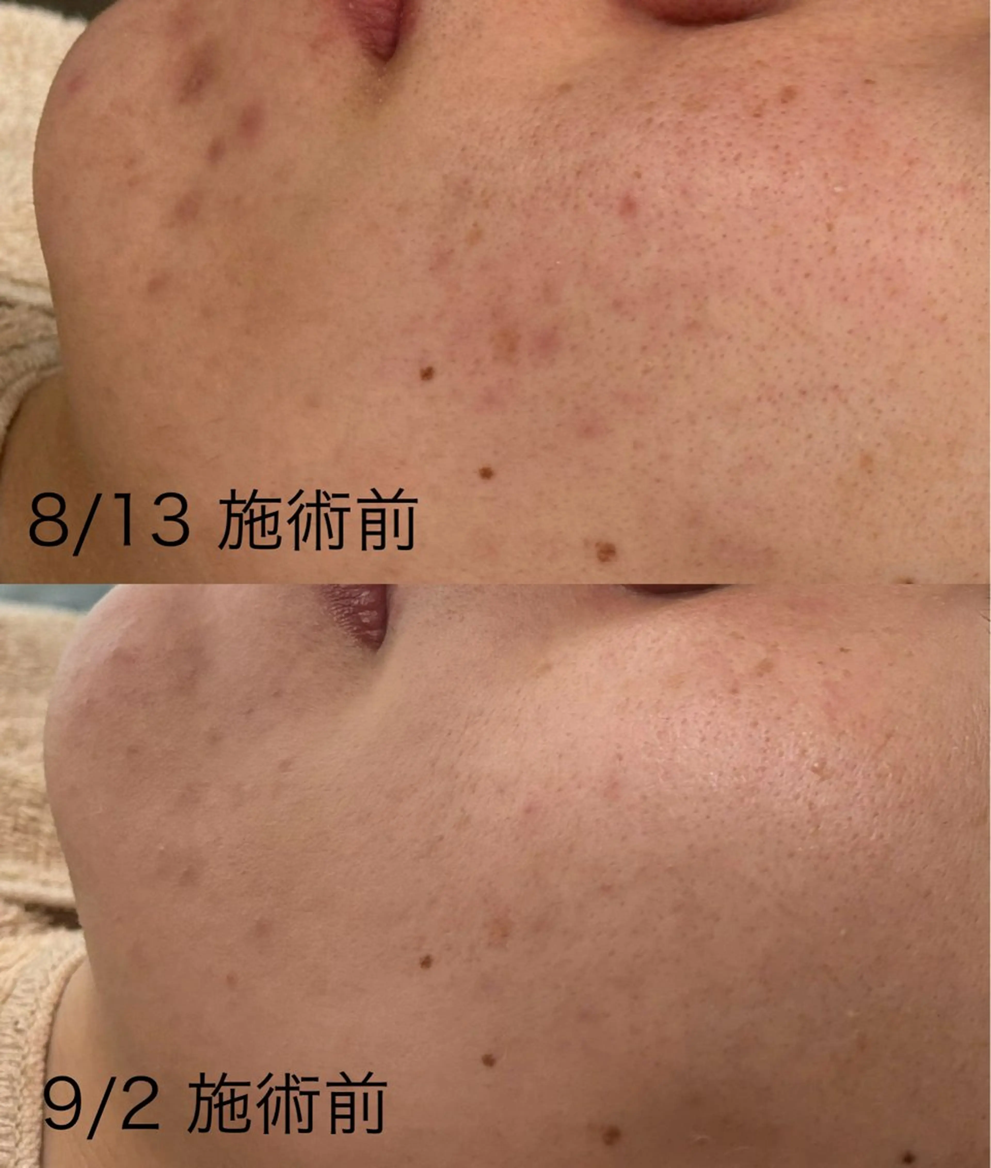 mili mili beauty salon所属・mili mili 岡本のエステ・リラクイメージ