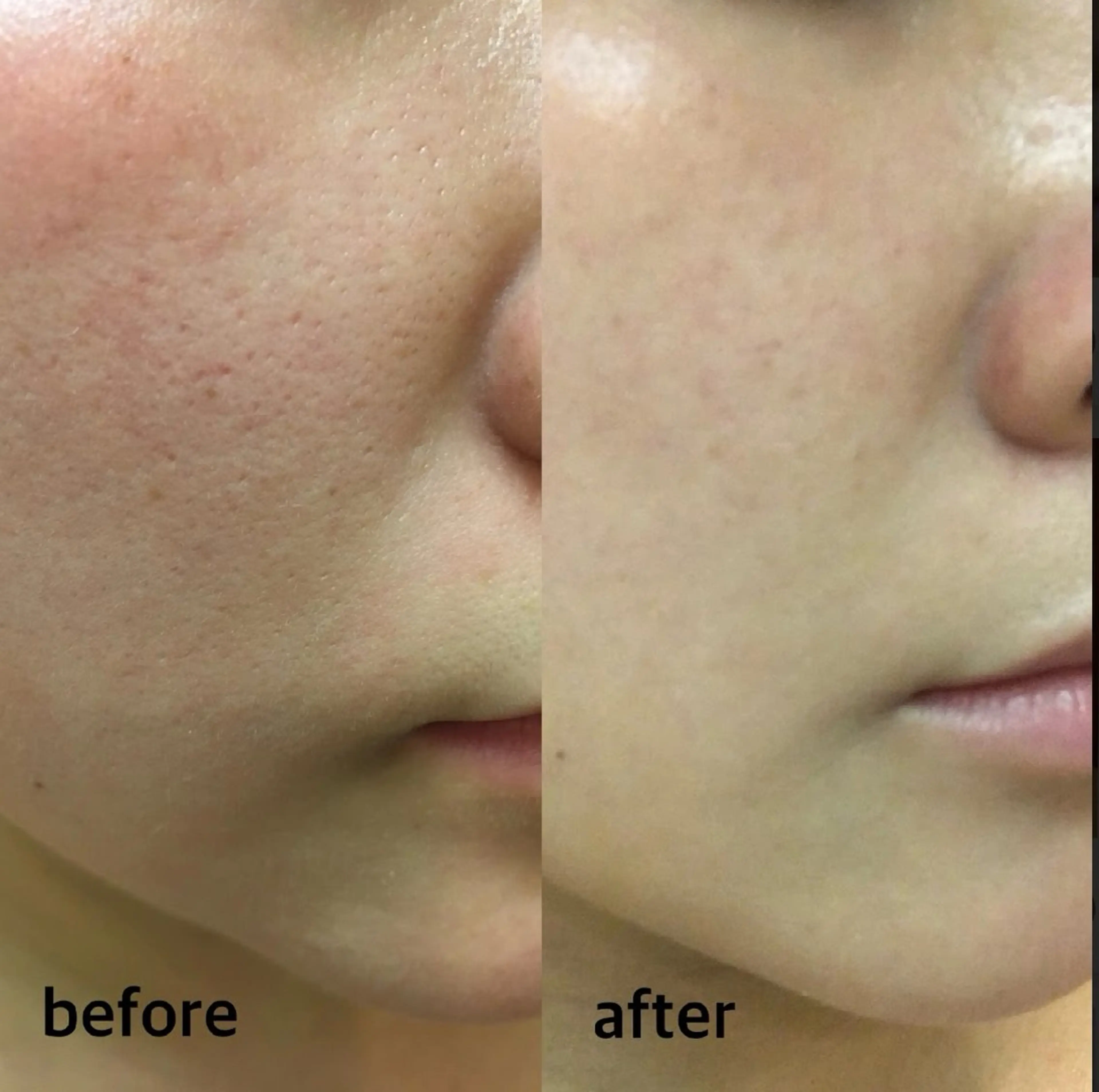 エステ ニキビ毛穴専門店Beautysalon Luana所属・小林 まいのエステ・リラクイメージ