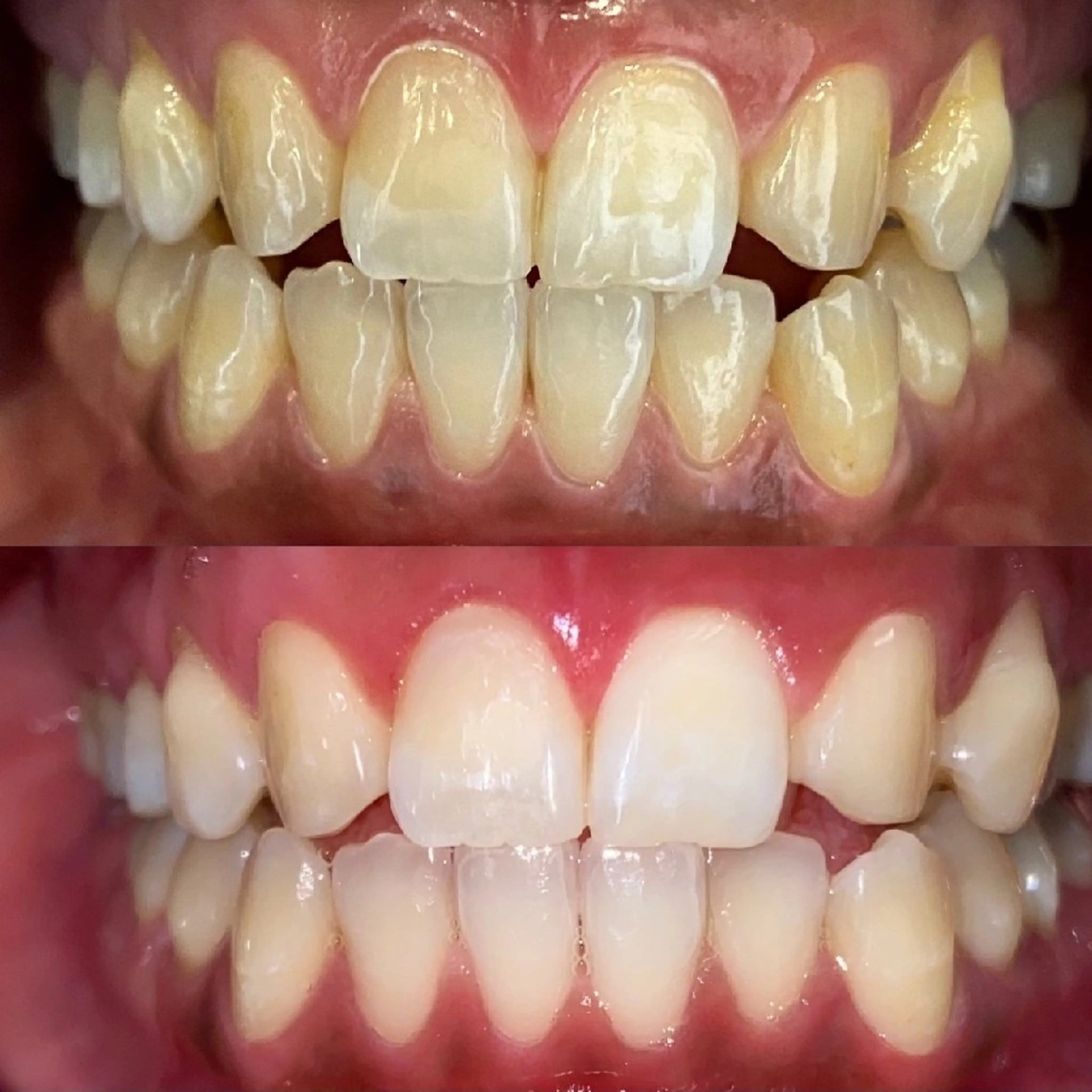 セルフホワイトニングビューティー三川店所属・中村 江梨香のその他イメージ