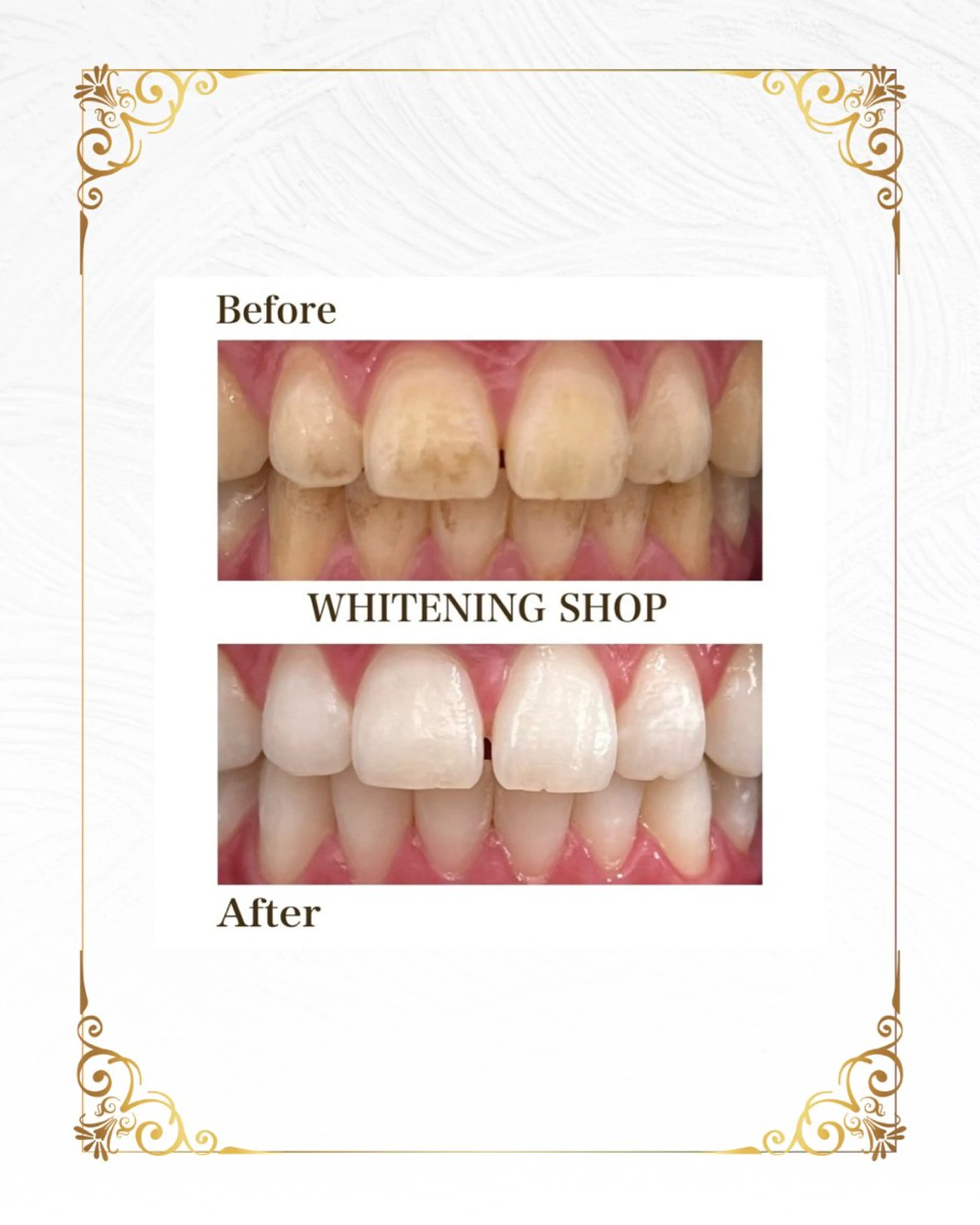 ホワイトニングショップ静岡葵区店所属・ホワイトニング ショップ葵区静岡駅店のその他イメージ