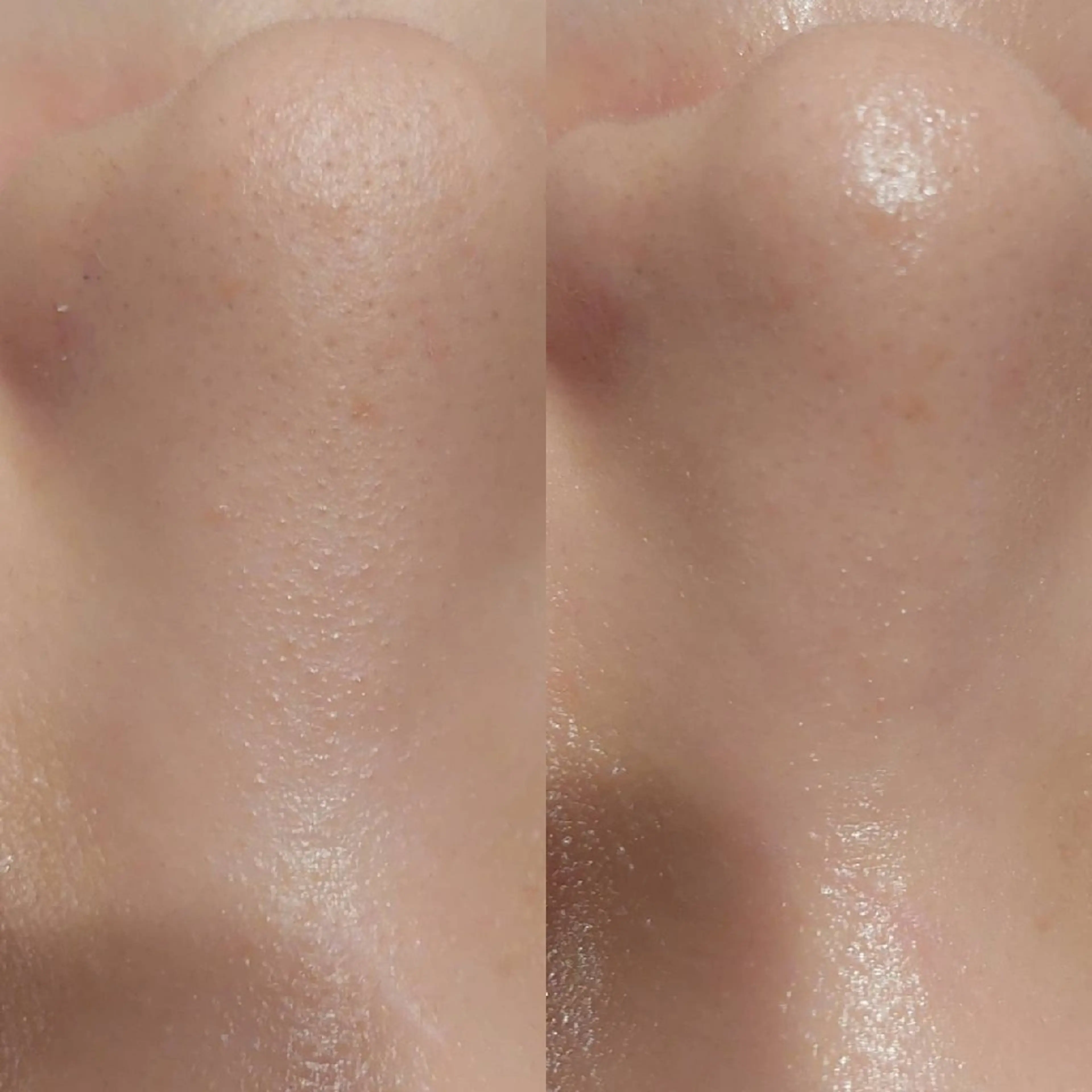 MyFairLady miuのエステ・リラクイメージ