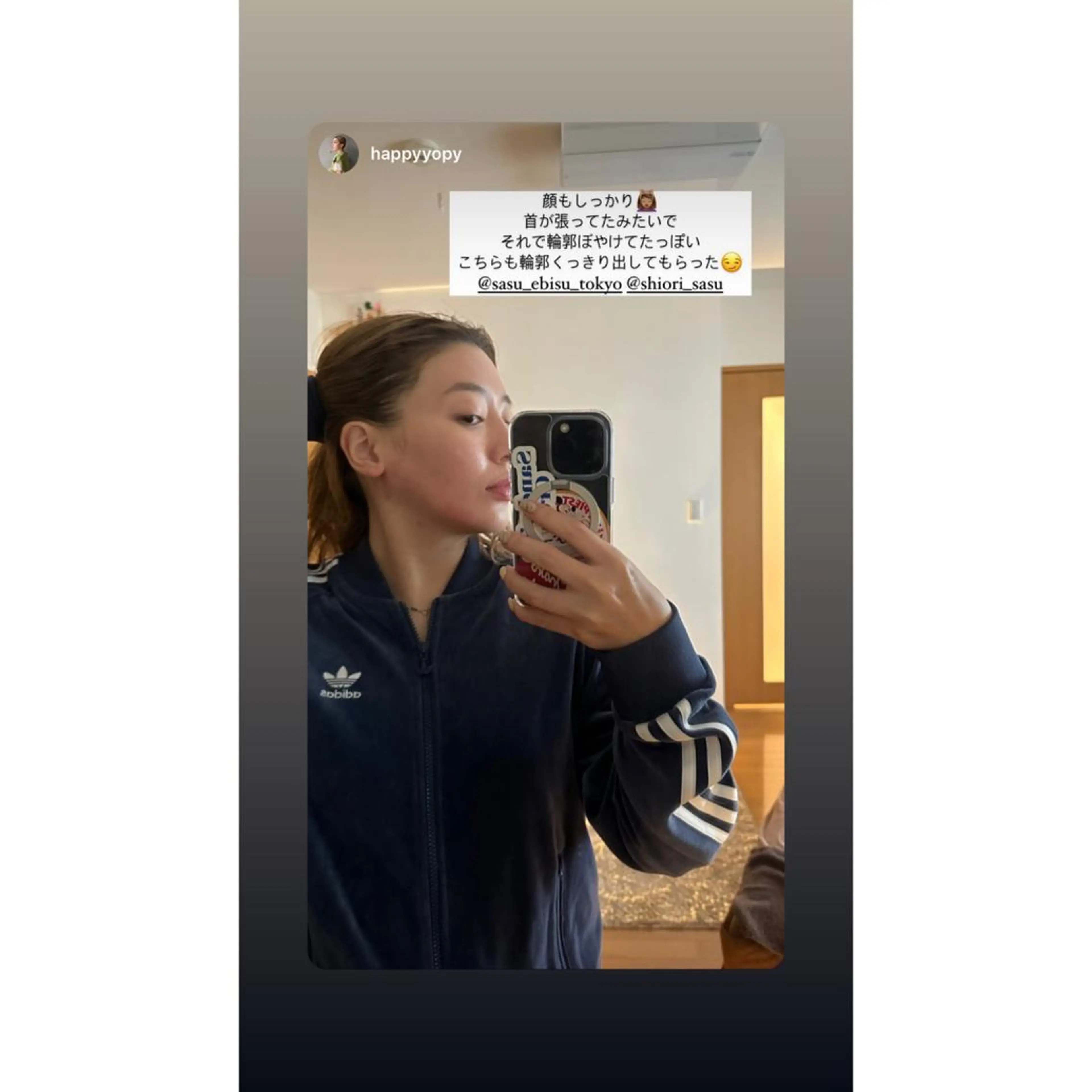 ロング パーマ ヘアアレンジ メンズ キッズ ネイル マツエク・マツパ アイブロウ その他 即小顔♥️美容鍼× ハーブピーリングのその他イメージ