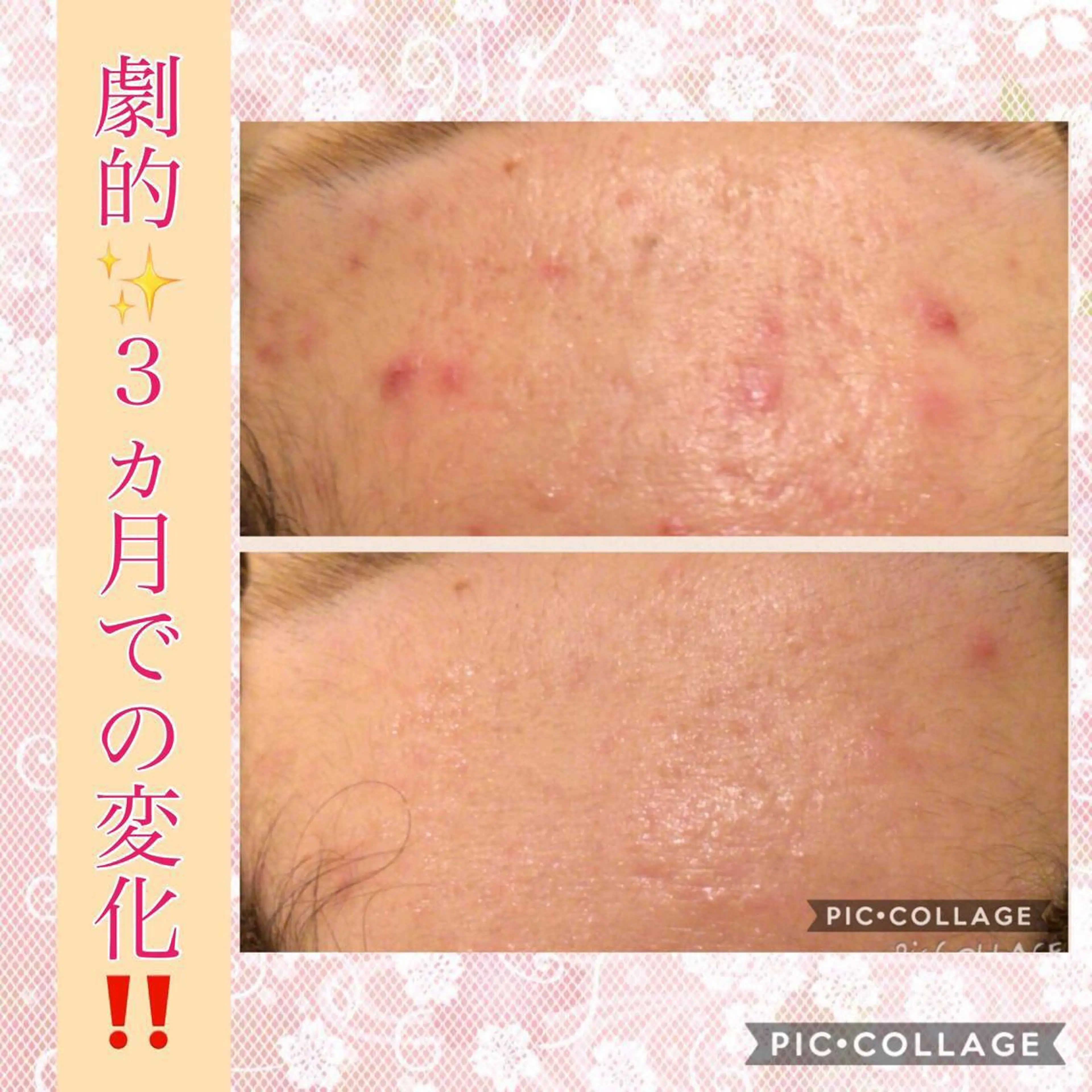 ショート カラー パーマ ヘアアレンジ メンズ キッズ ネイル マツエク・マツパ ニキビ・肌質改善専門 ♡人生が変わるサロンのエステ・リラクイメージ