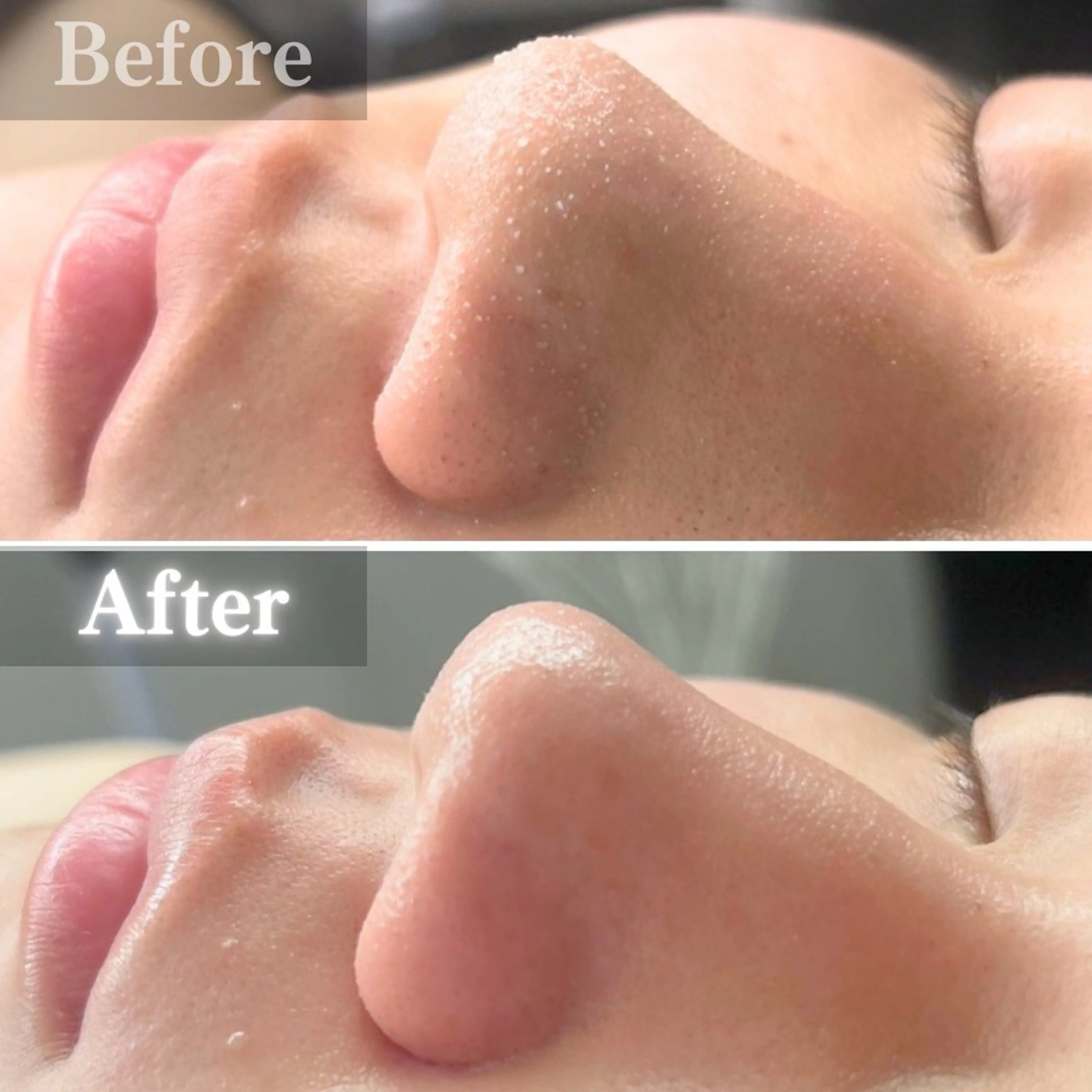 エステ 毛穴洗浄特化🫧 オオツカのエステ・リラクイメージ