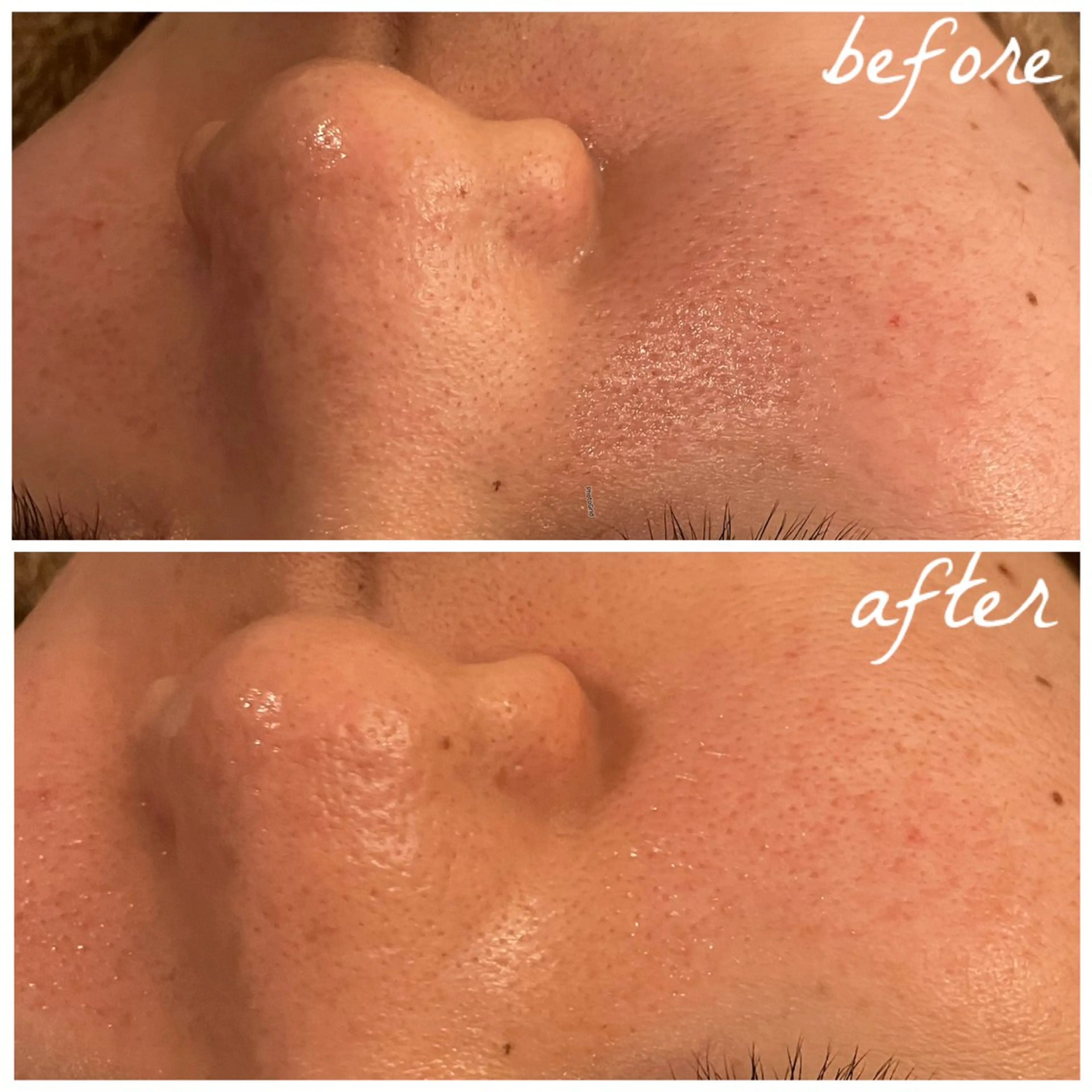 メンズ エステ メナード岐阜茜部 杉浦のエステ・リラクイメージ