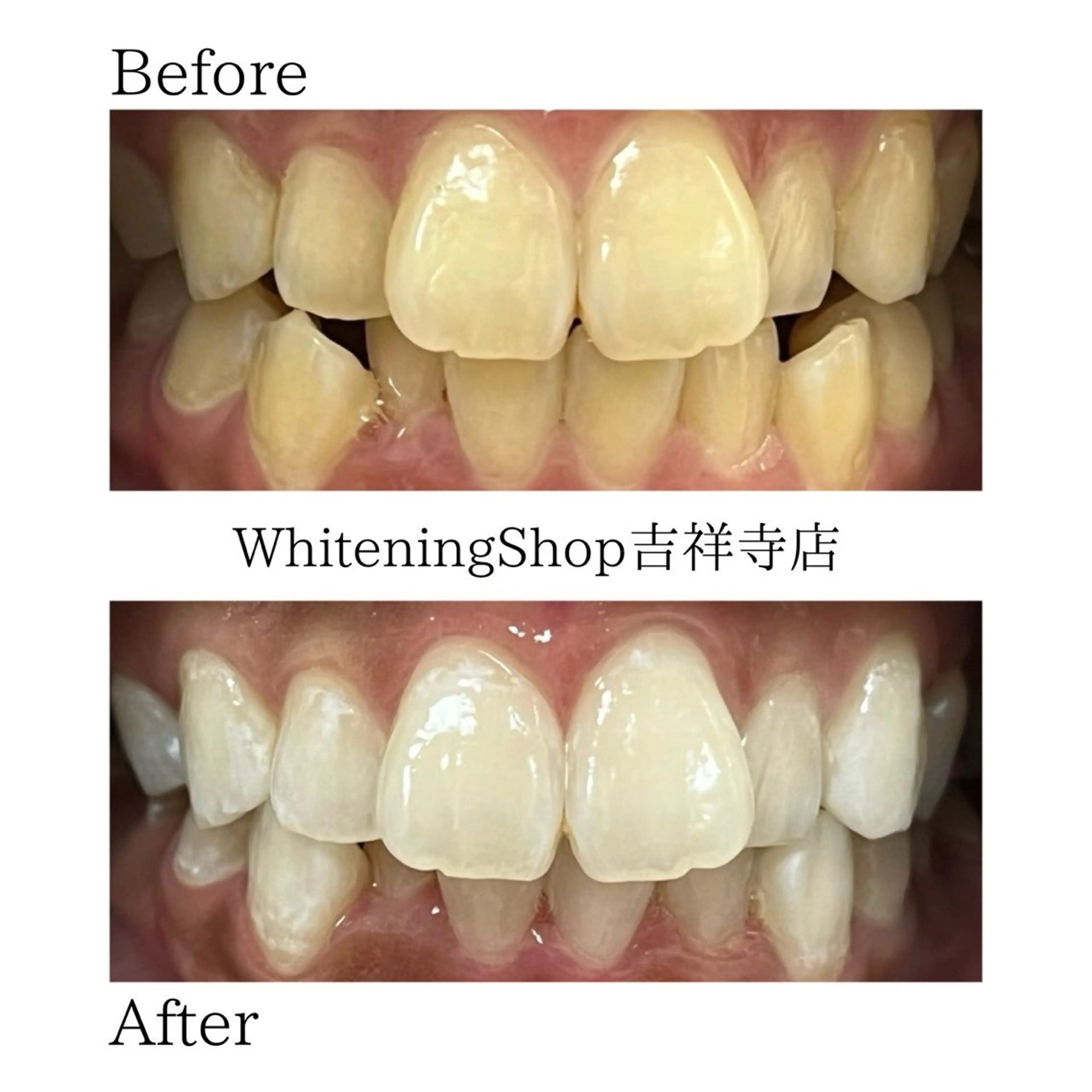 エステ リラク ホワイトニング ショップ吉祥寺店のエステ・リラクイメージ