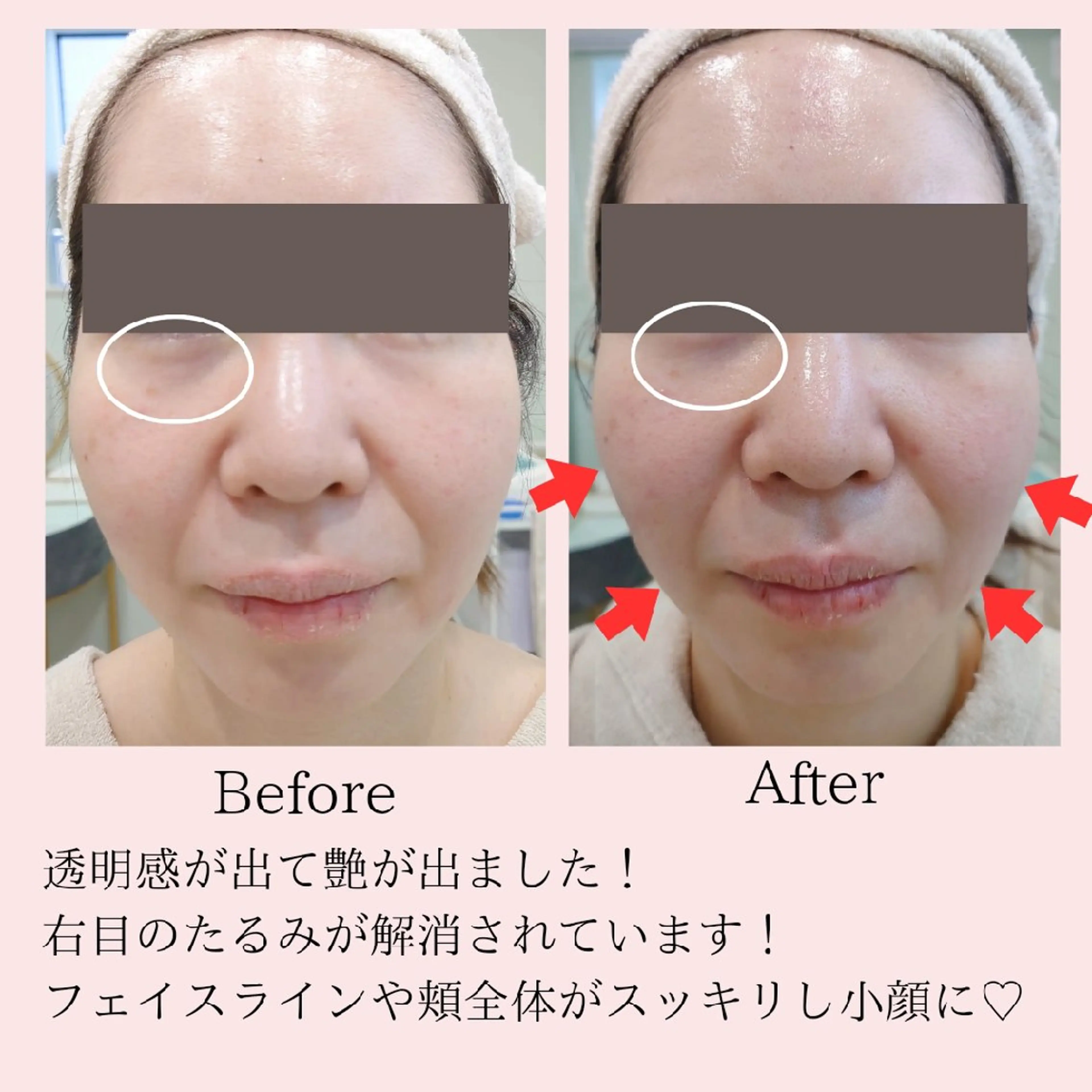 エステ PRETTIEST SHINE所属・フェイシャル/ボディ /ブライダル山田浩子のエステ・リラクイメージ