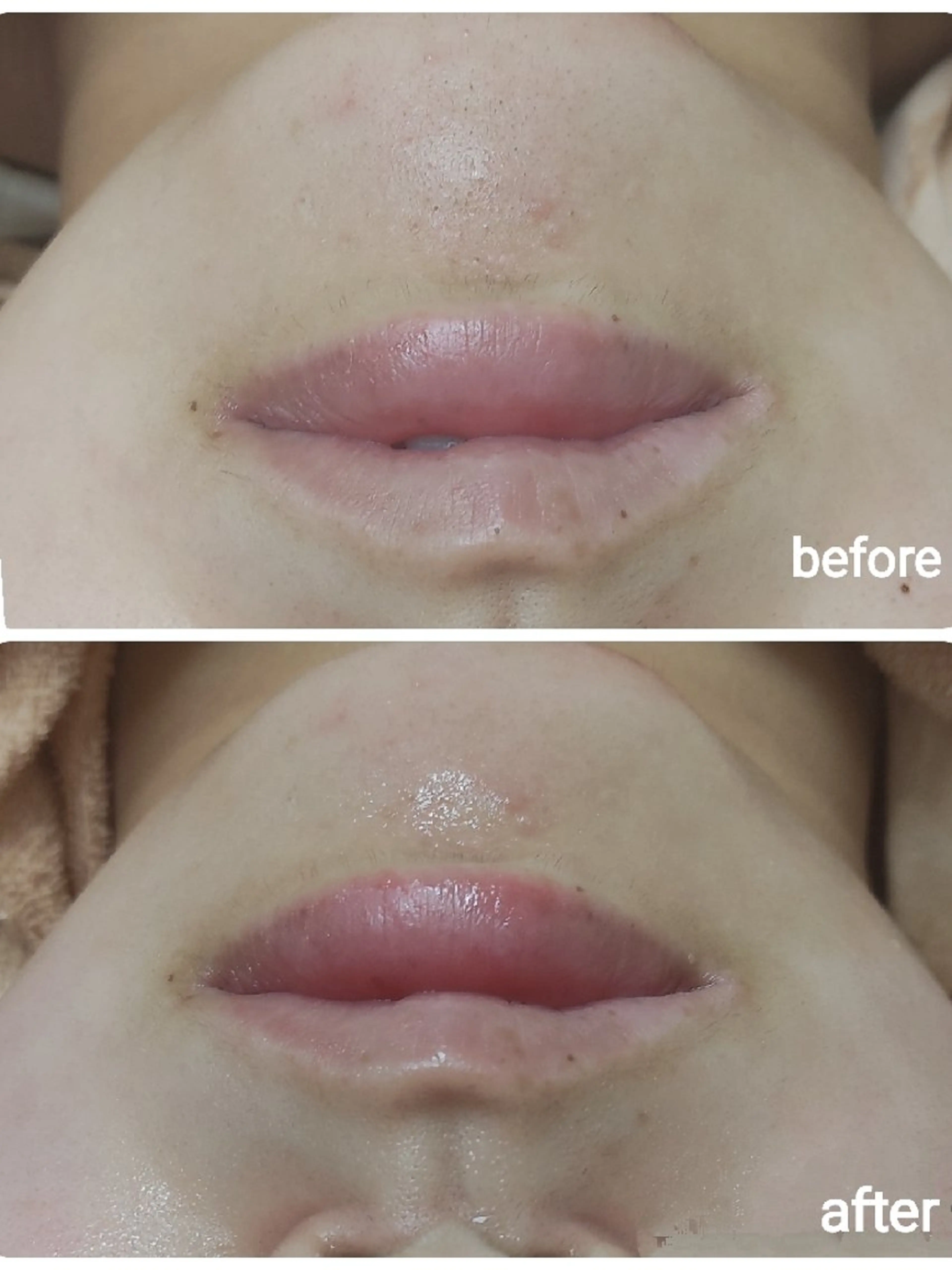 エステ リラク 山野愛子どろんこ美容〜Lough〜所属・山野愛子どろんこ美容 Loughのエステ・リラクイメージ