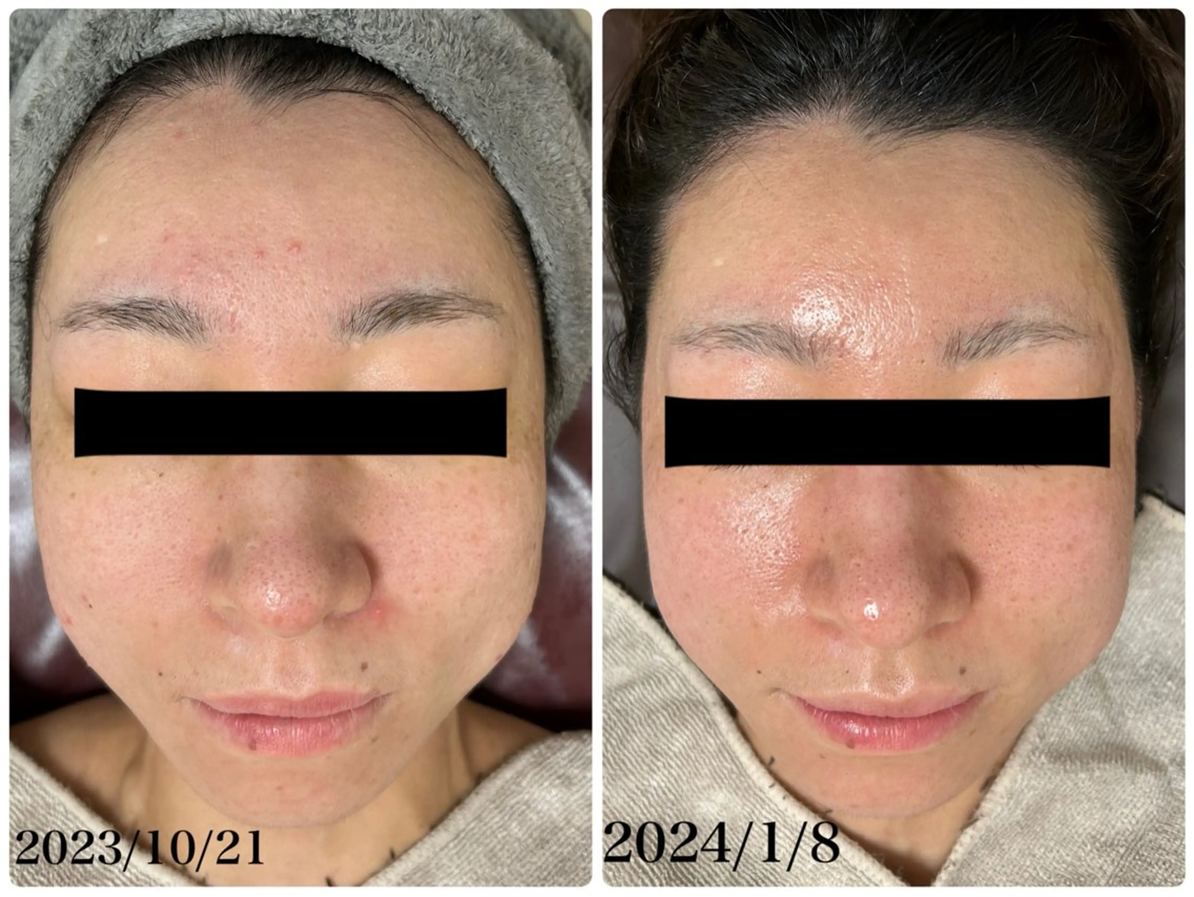 エステ REBORN by ami-goのその他イメージ