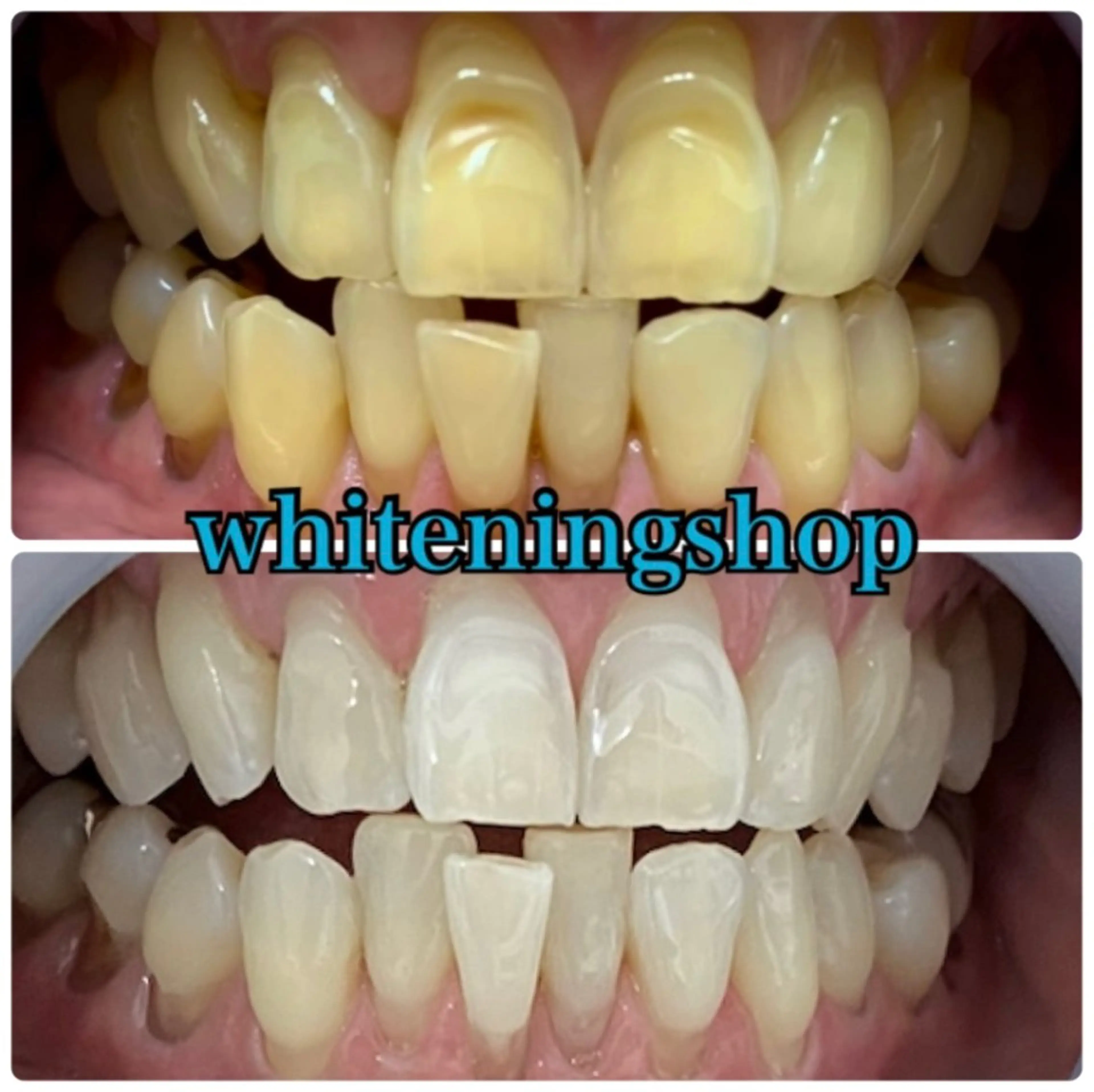 エステ リラク ホワイトニング ショップ吉祥寺店のエステ・リラクイメージ