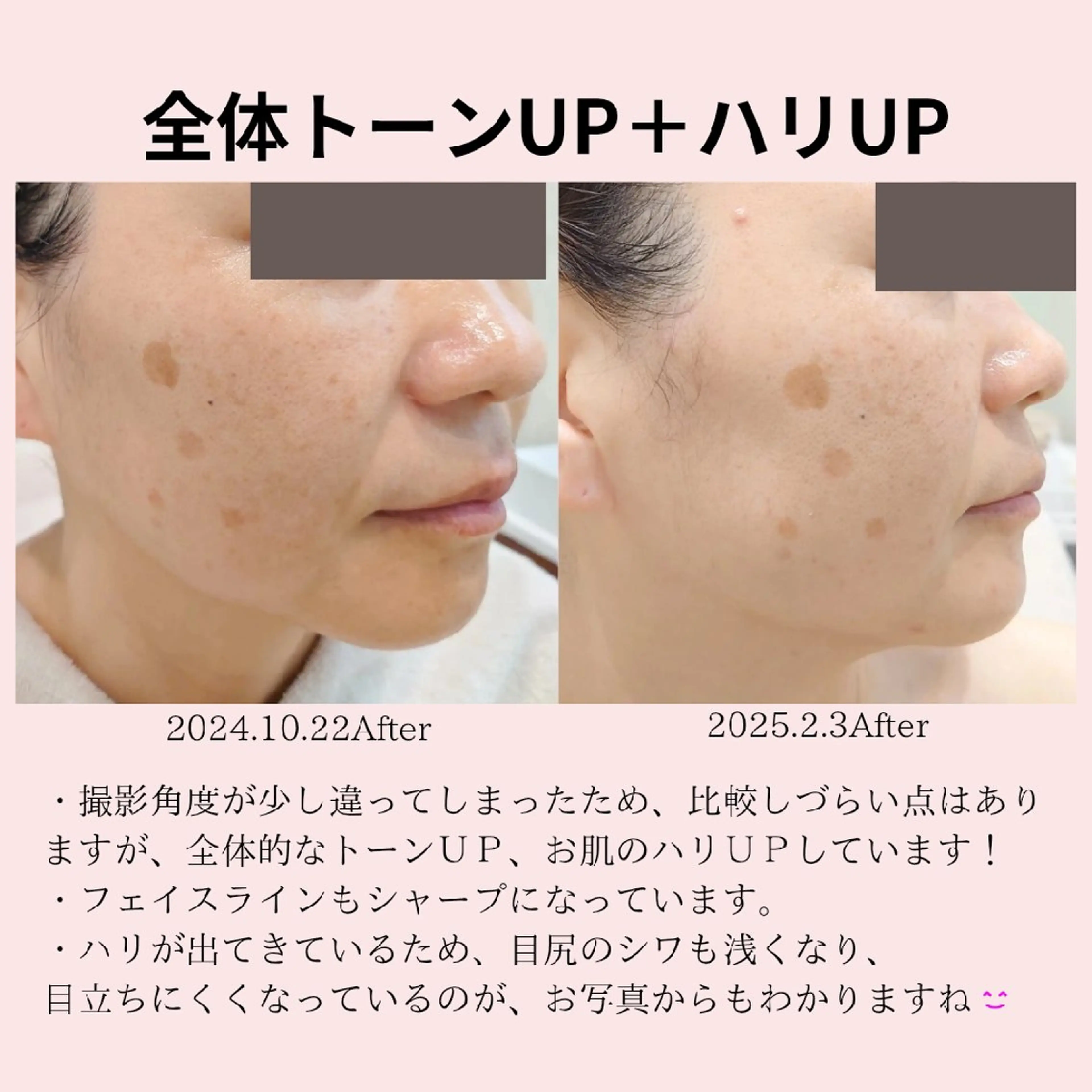 エステ PRETTIEST SHINE所属・山田 浩子のエステ・リラクイメージ