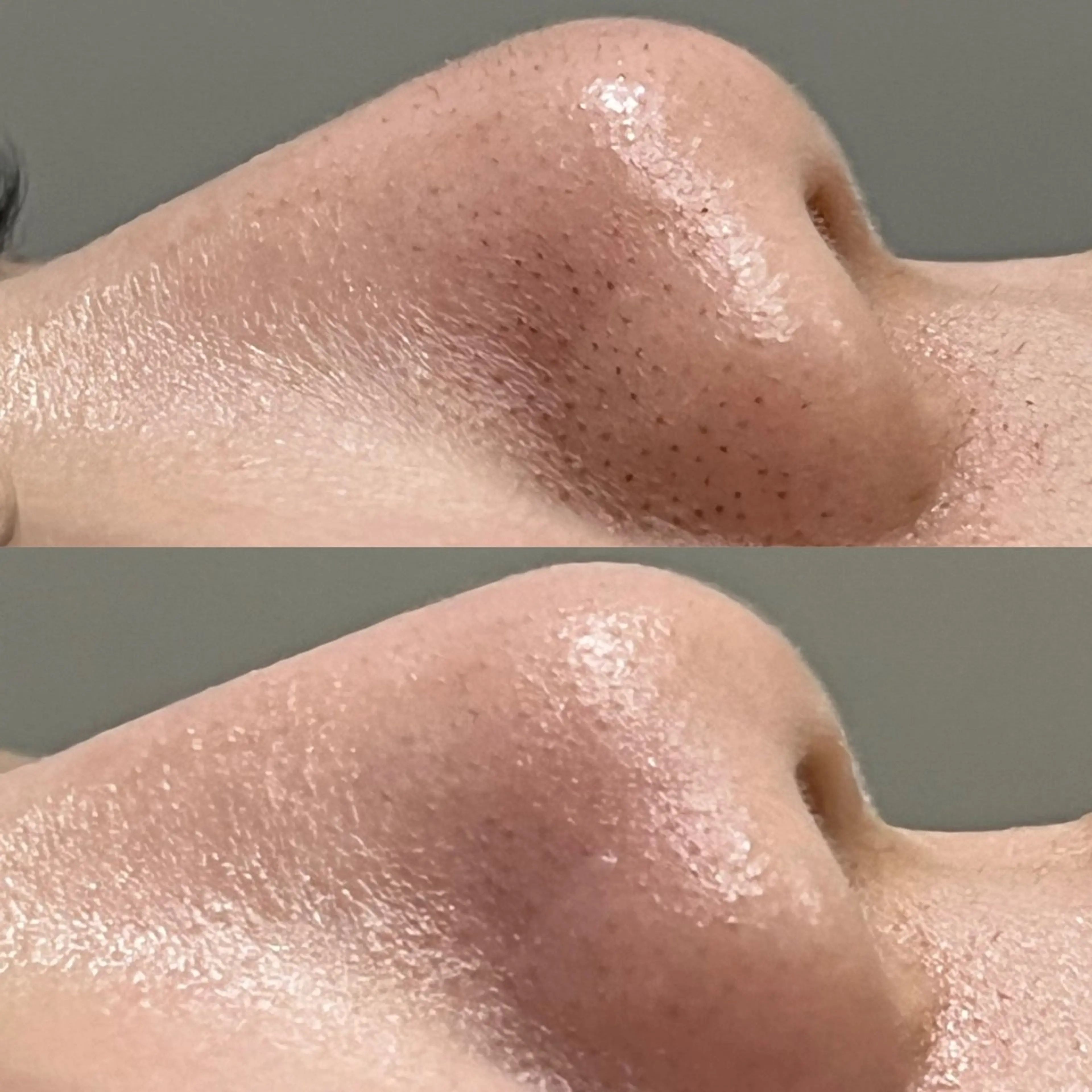 LICO_NEE_所属・LICO_NEE_ yukikoのエステ・リラクイメージ