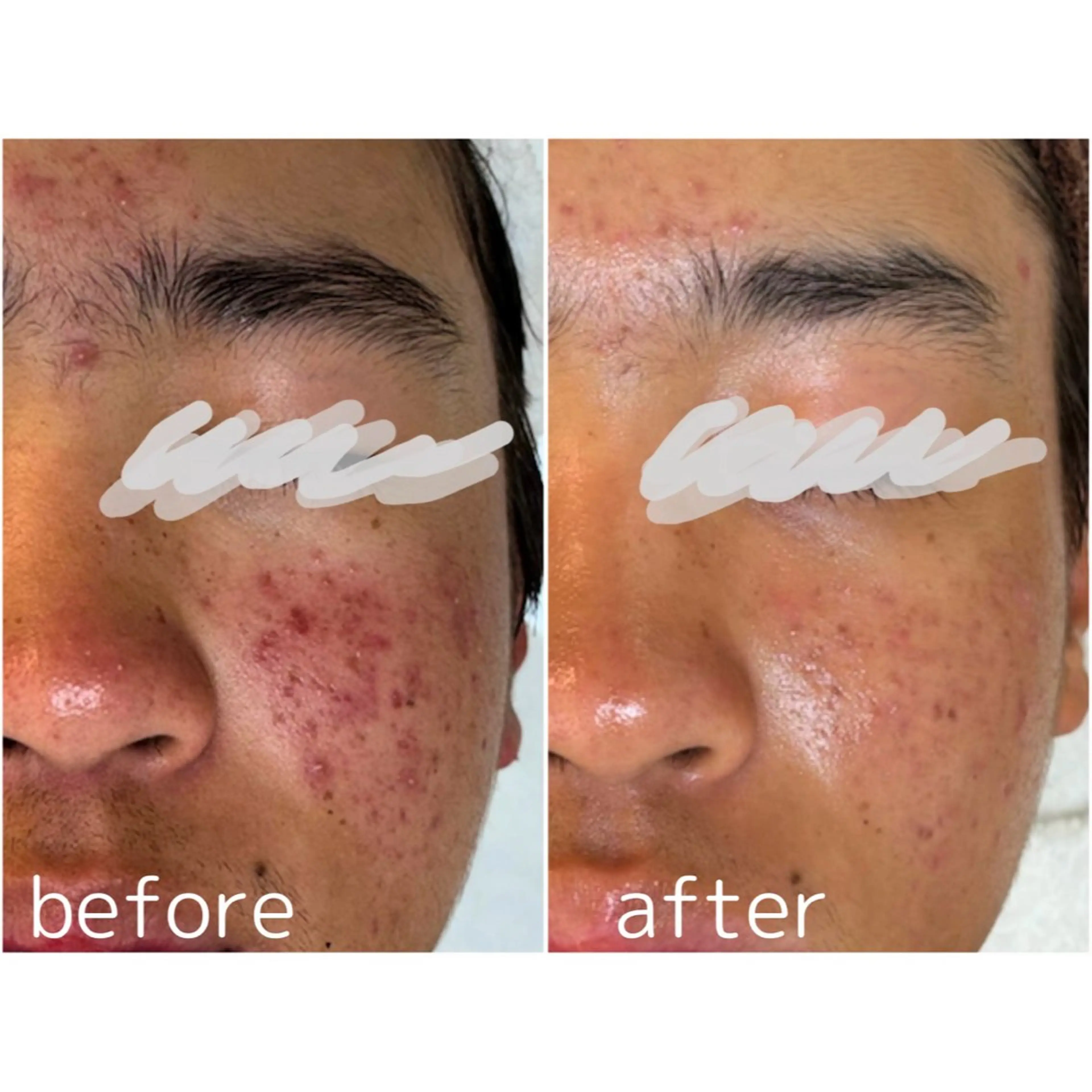 エステ For...天王寺店 リンパ|ヘッドよもぎのエステ・リラクイメージ