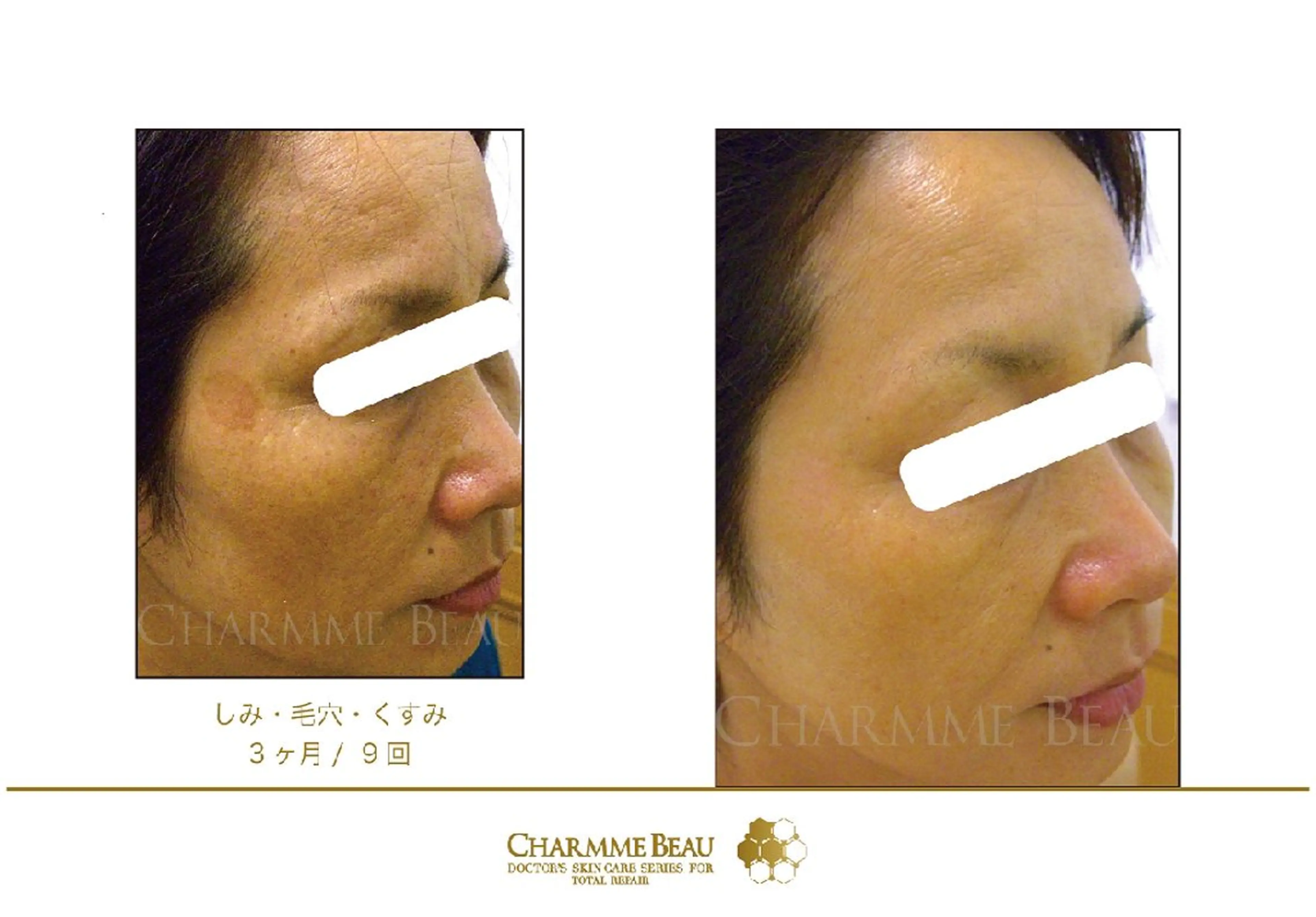 肌質改善サロン renew所属・肌質改善サロン renew/ｳｴｷのエステ・リラクイメージ