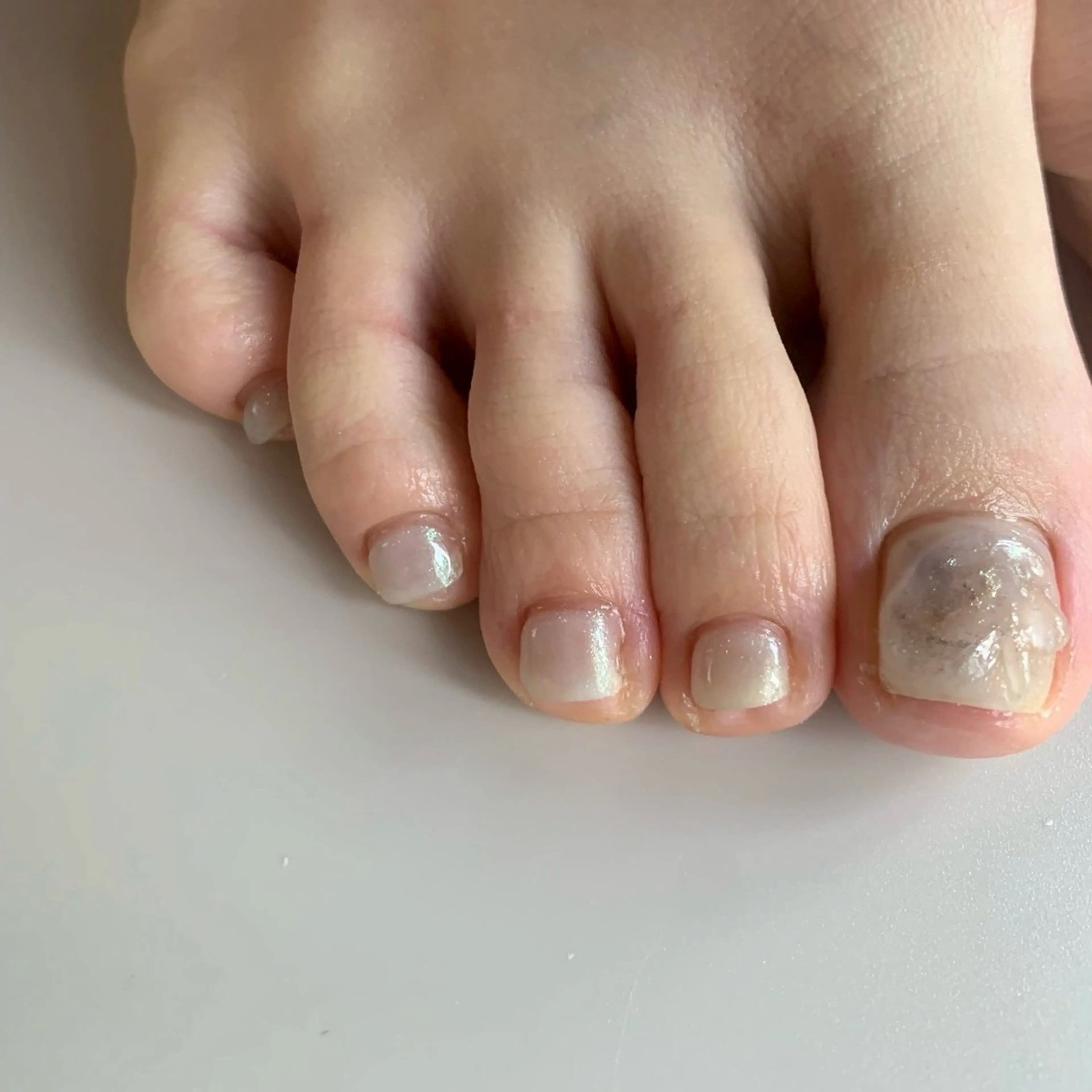 フット親指2本アート(オフなし)の写真