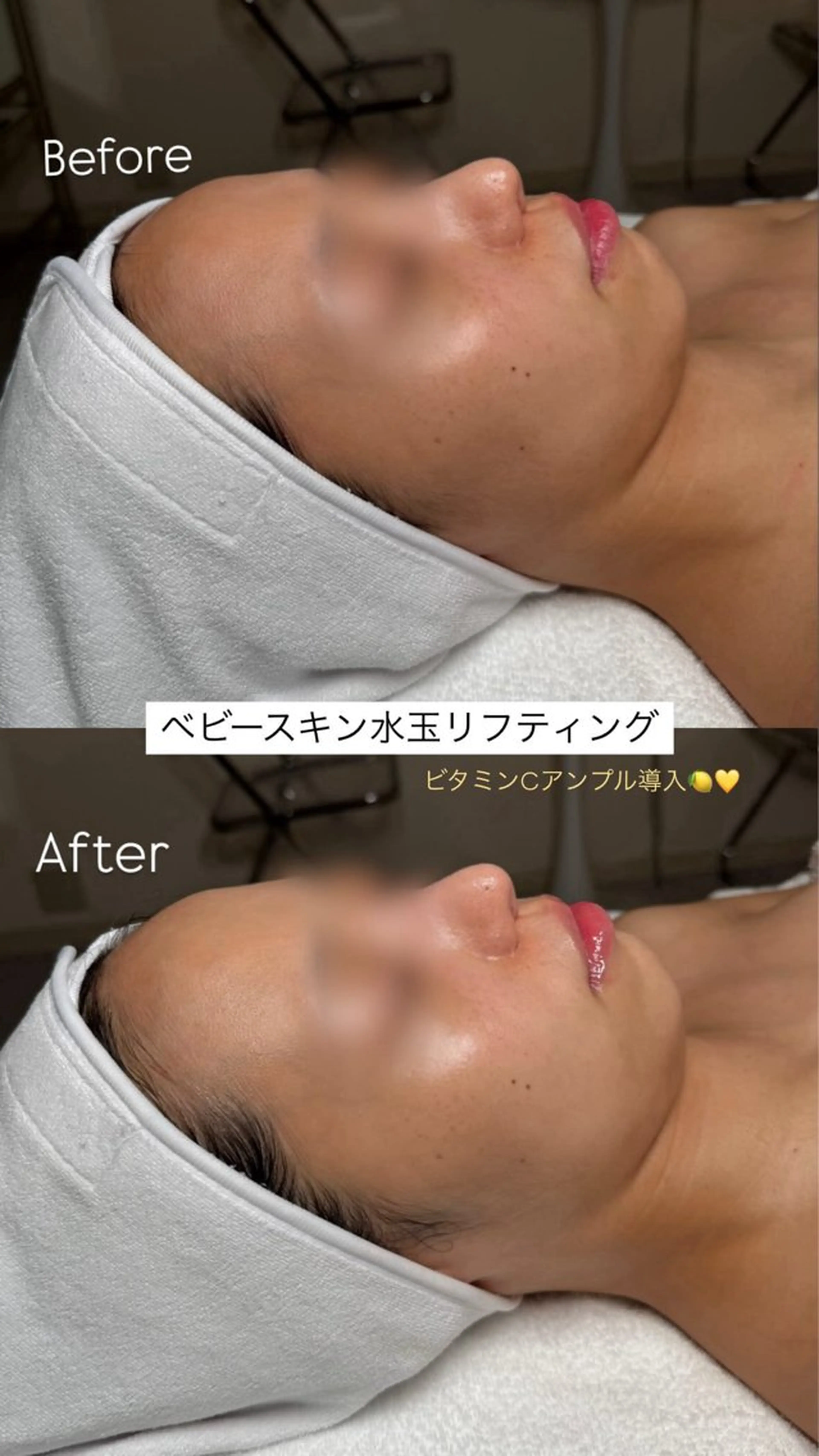 韓国肌管理🫧LDM 🫧Junnaのエステ・リラクイメージ