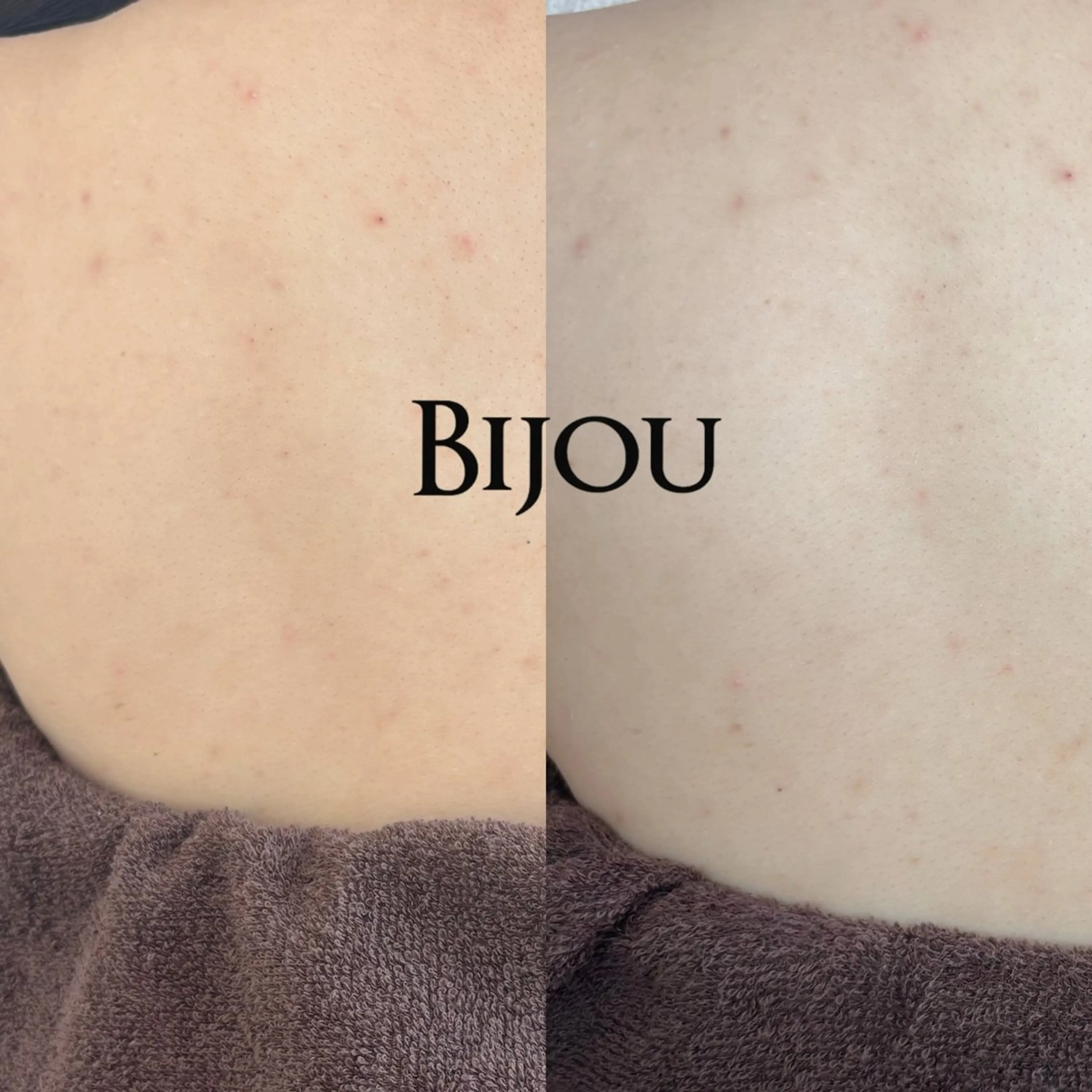 その他 Bijou(ビジュー)所属・Bijou💎 MARIの眉毛・アイブロウイメージ