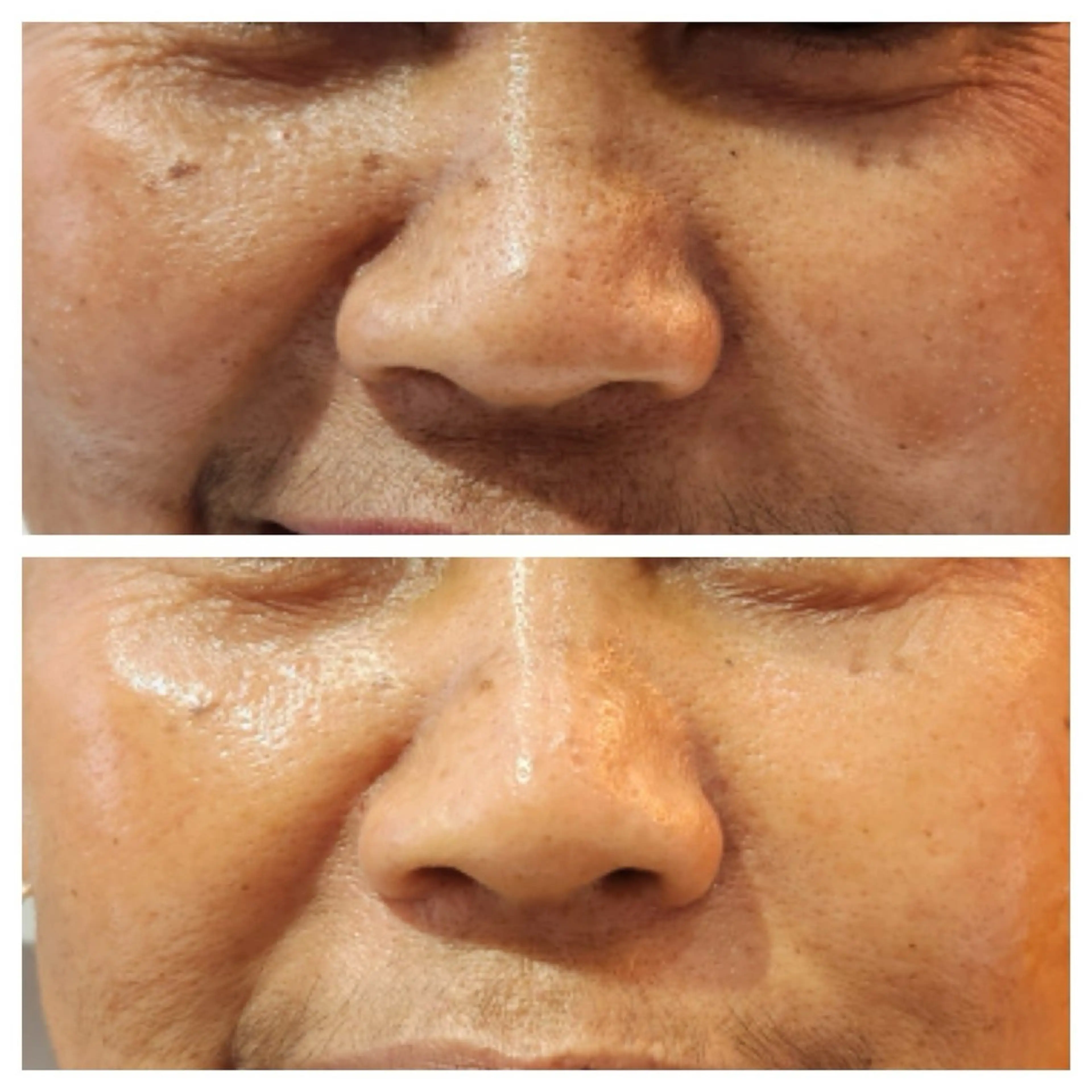 表参道鍼灸院K 美容鍼🔮ララピールのエステ・リラクイメージ