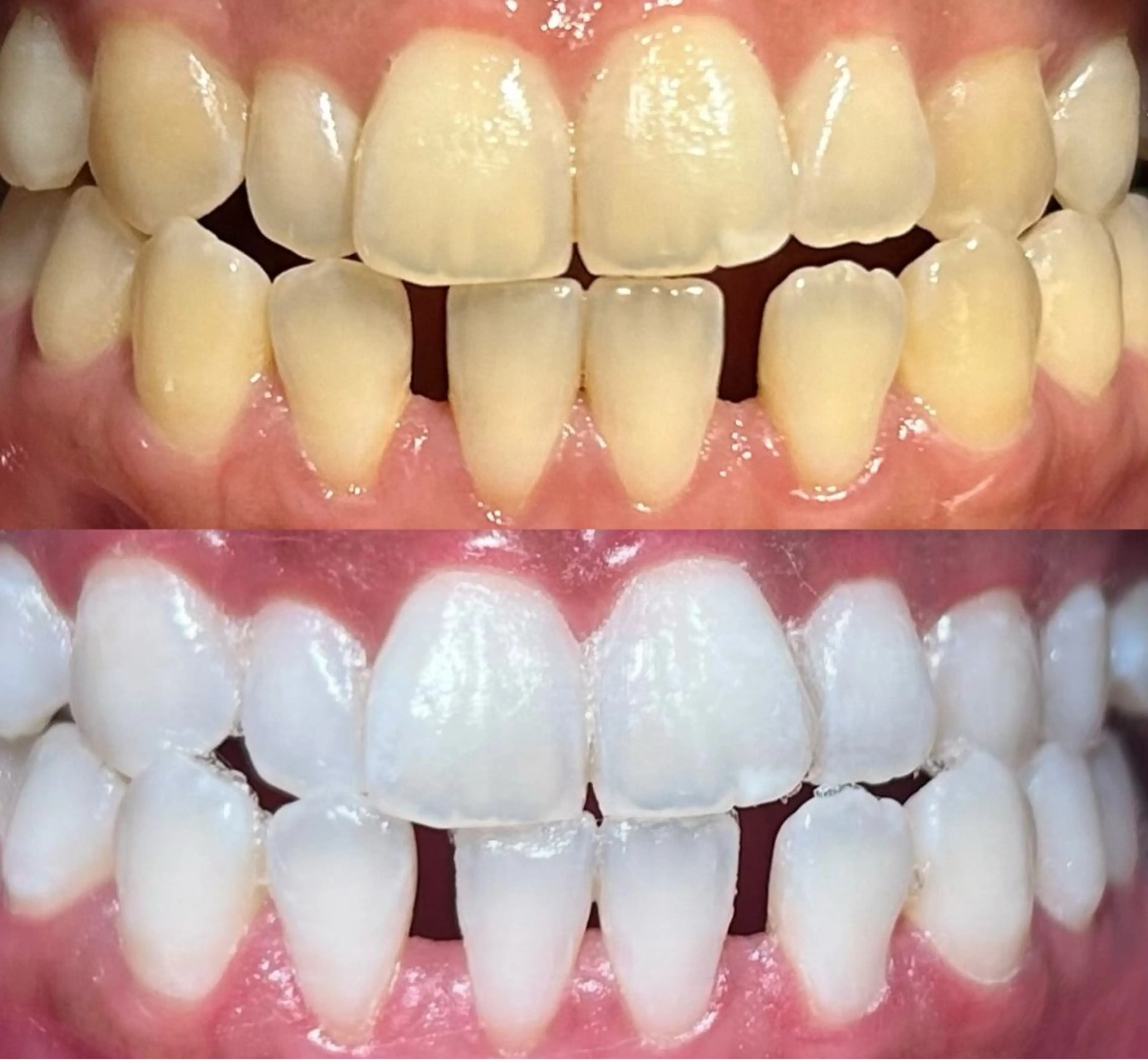 io teeth careのその他イメージ