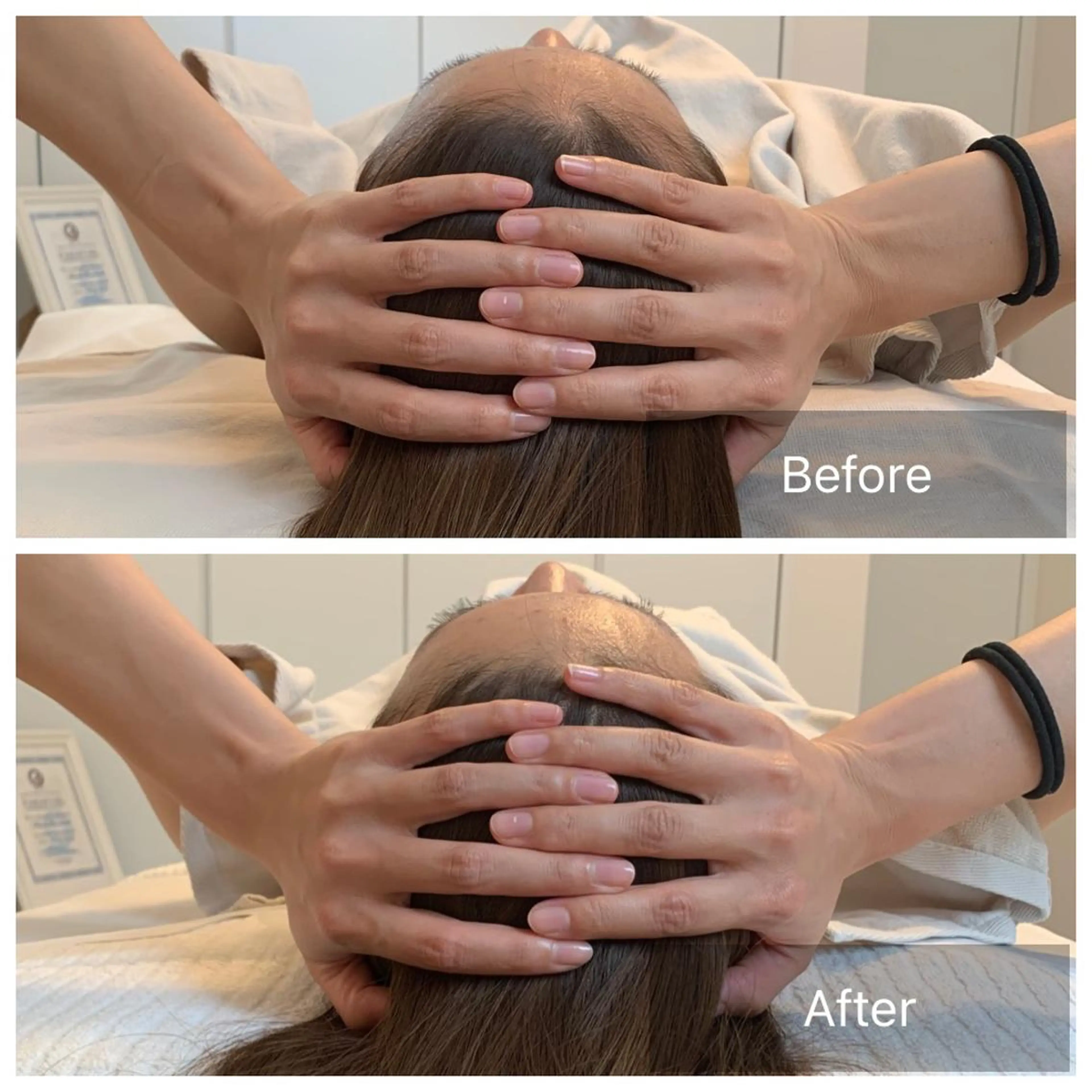 脳洗浄小顔調整ショート70分の写真