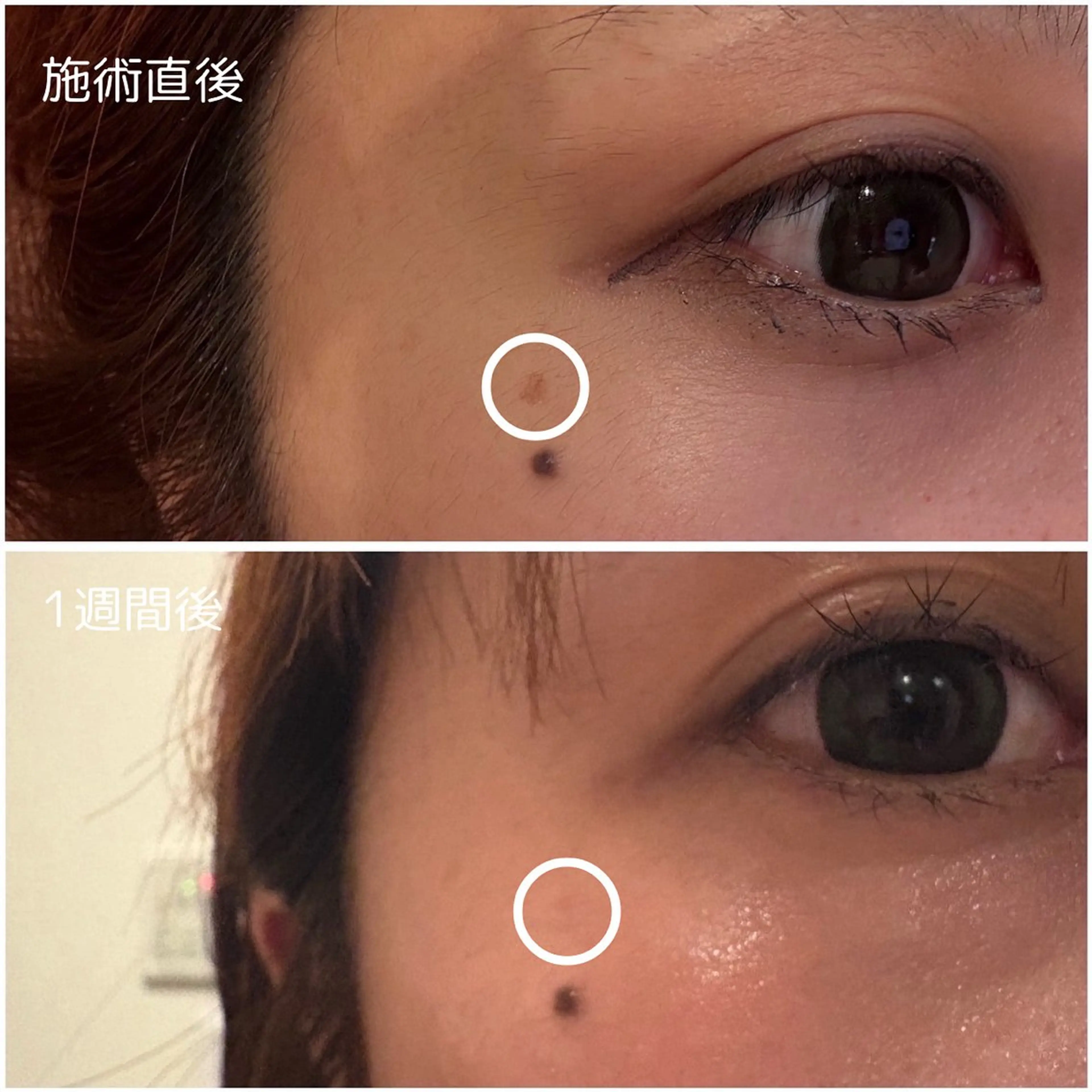 その他 MORE BEAUTY ESTHE 本通り店所属・more ‎‪𓍯 ‬のエステ・リラクイメージ