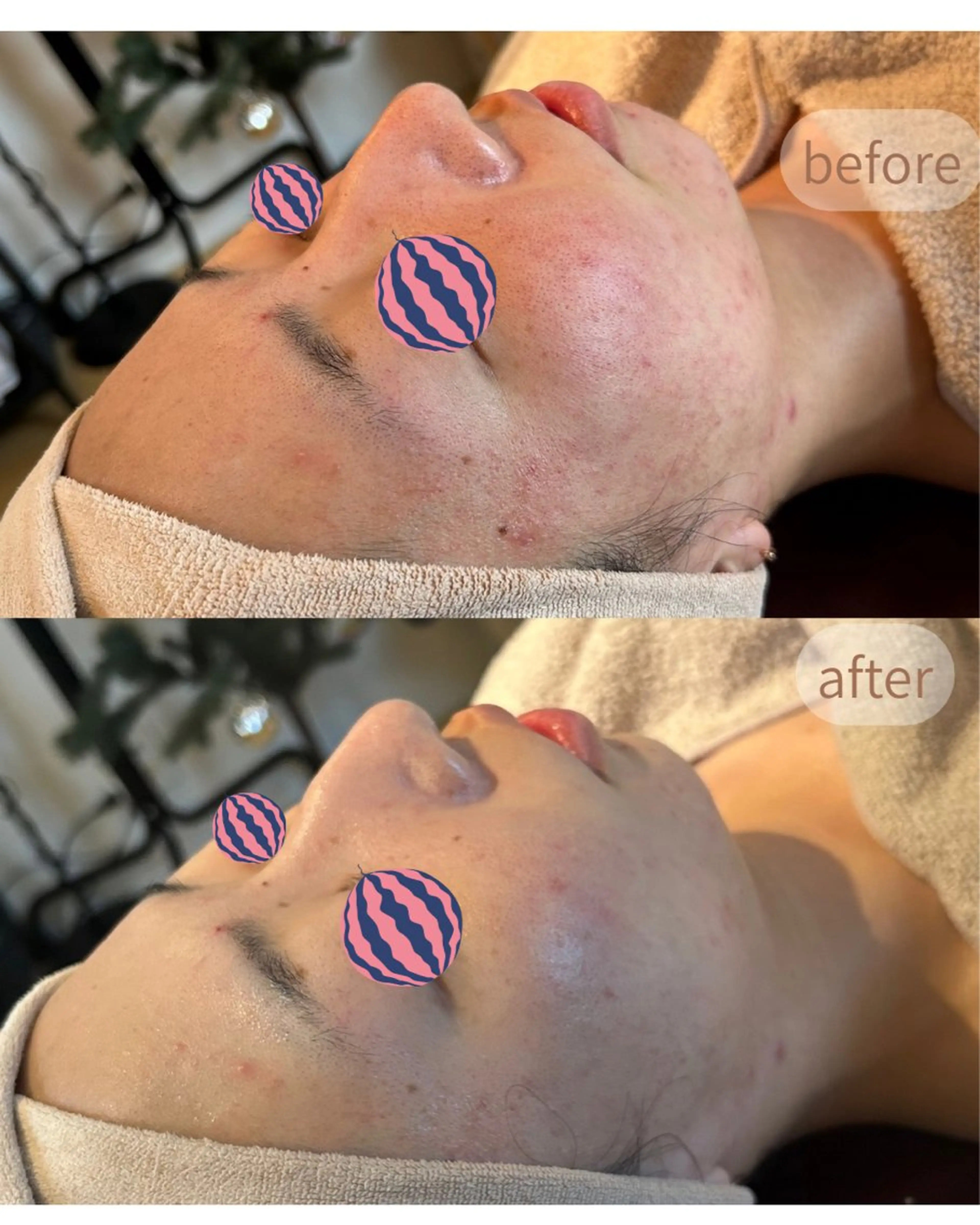 エステ MiEL total beauty salon所属・Rie ×MiELのエステ・リラクイメージ