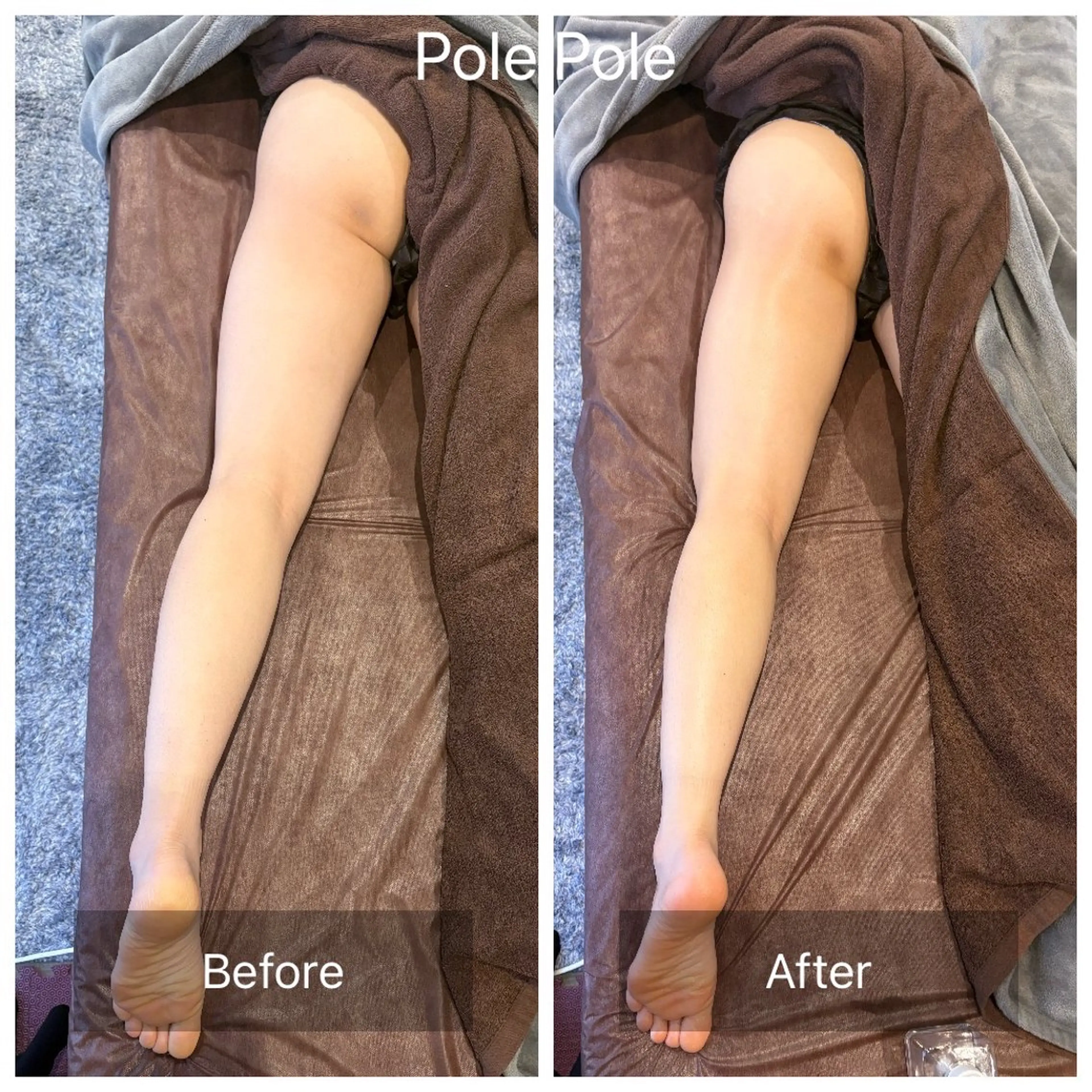 キッズ Pole Poleのエステ・リラクイメージ