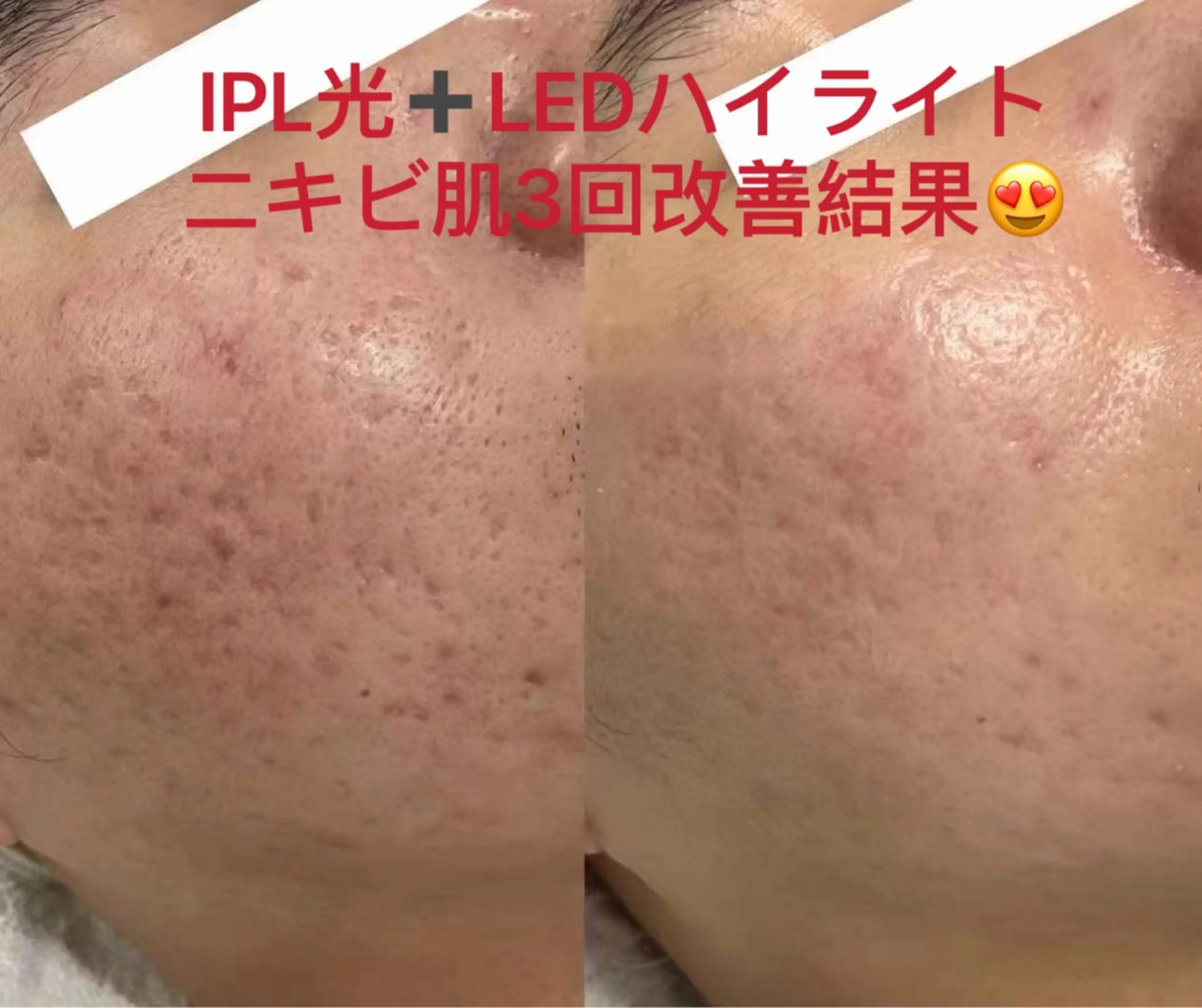 肌管理専門店 Shandeelのエステ・リラクイメージ