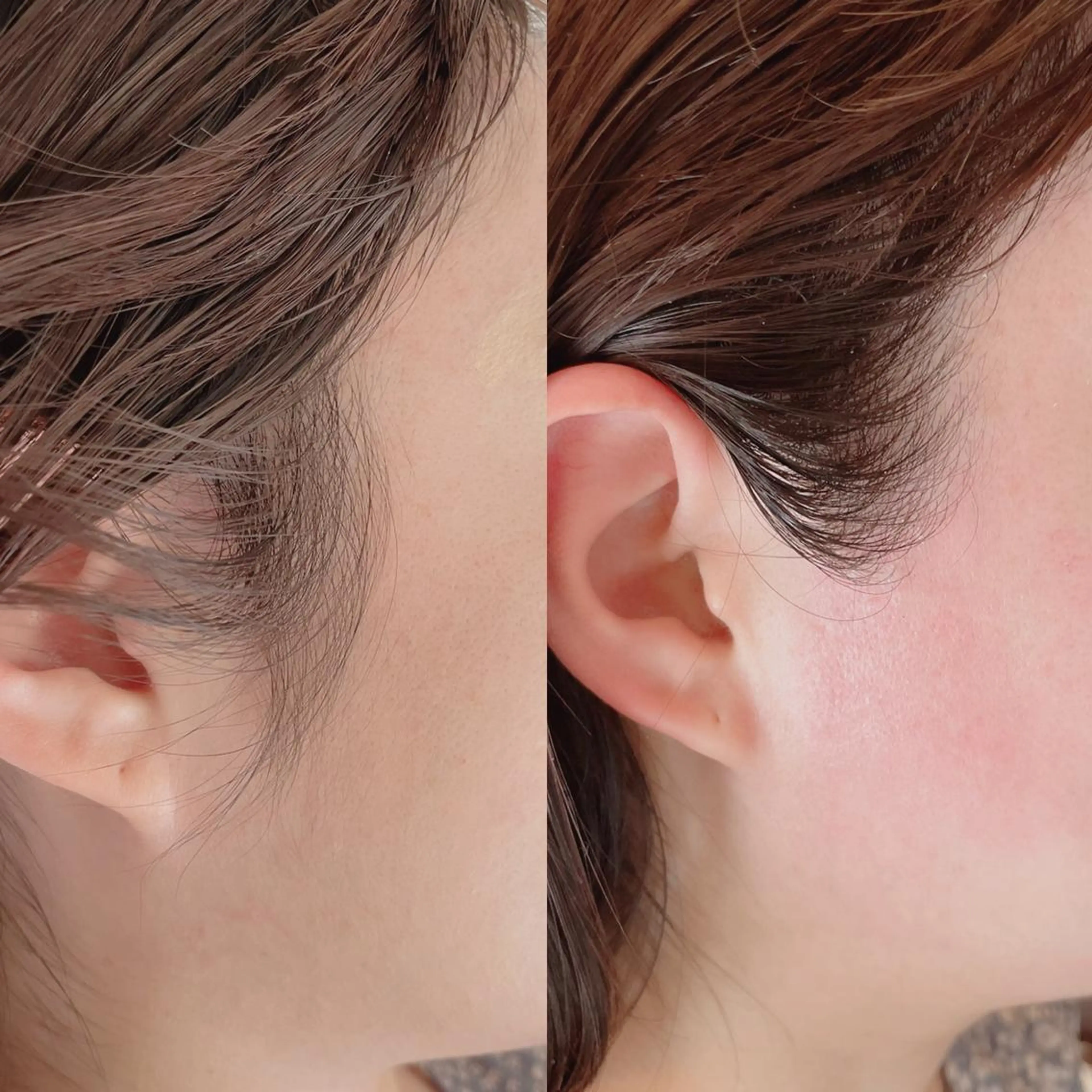 アイブロウ 眉毛ワックス脱毛 Tsumuji所属・tsumuji umiのマツエク・マツパデザイン