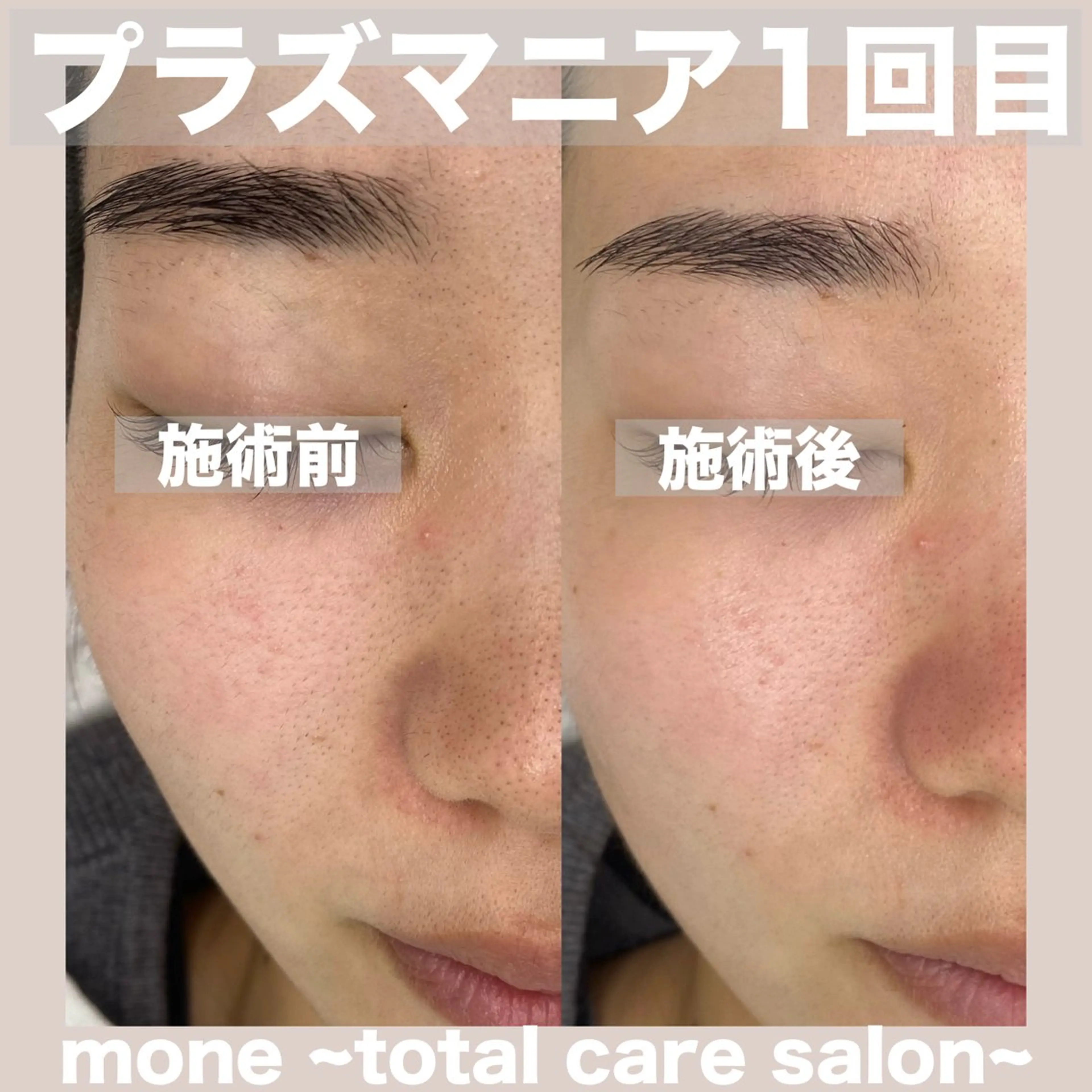エステ mone~total care salon~所属・mone (モーネ)のマツエク・マツパデザイン