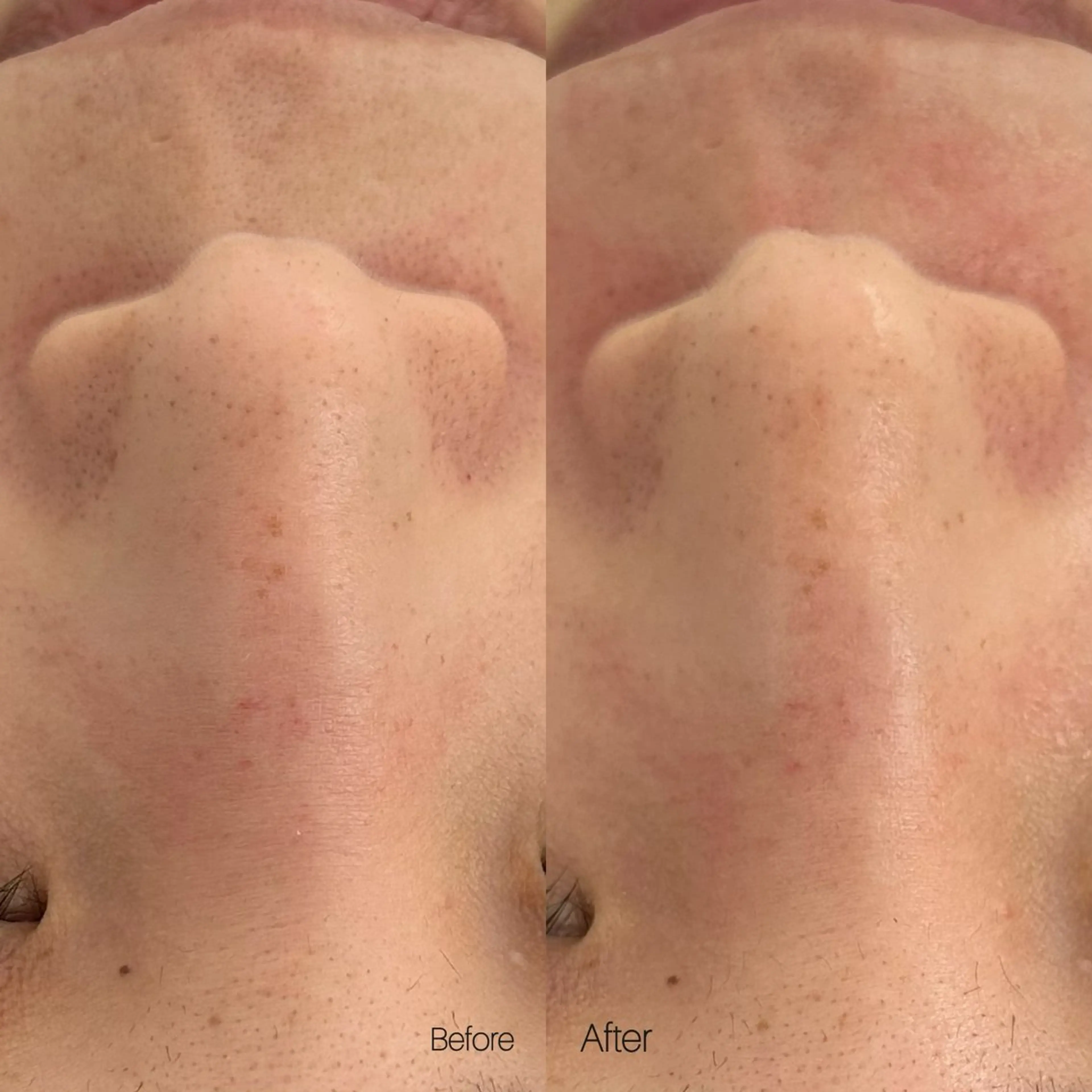 〈etre〉トータルビューティーサロン所属・etre - 韓国肌管理 -のエステ・リラクイメージ