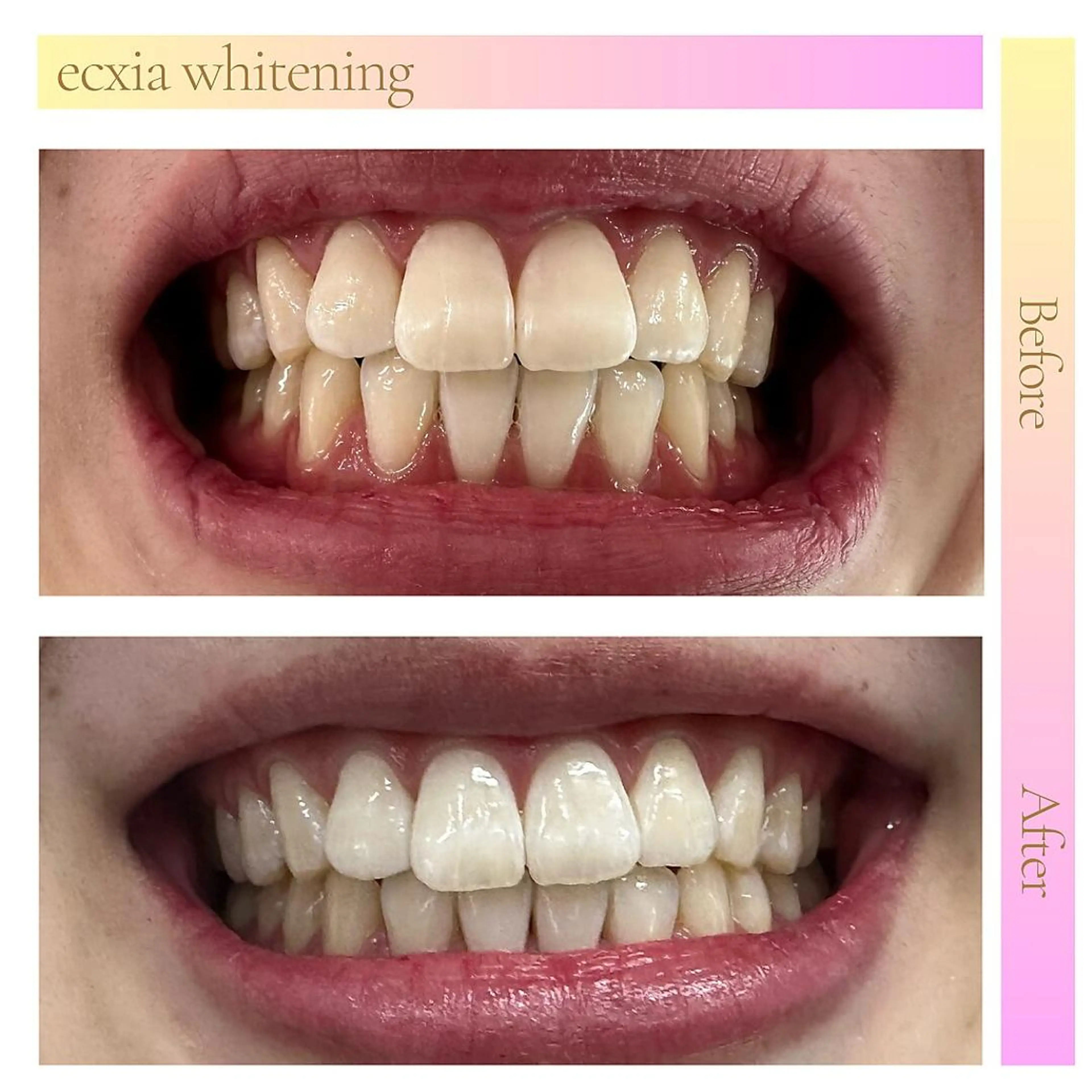 その他 セルフホワイトニング エクシア六本木店のその他イメージ